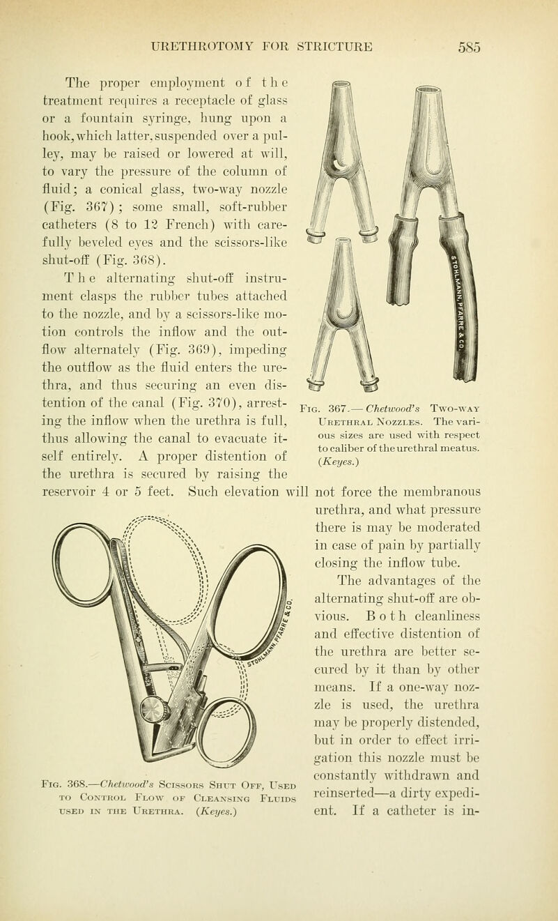 The proper employment of the treatment requires a receptacle of glass or a fountain syringe, hung upon a hook, which latter,suspended over a pul- ley, may be raised or lowered at will, to vary the pressure of the column of fluid; a conical glass, two-way nozzle (Fig. 367) ; some small, soft-rubber catheters (8 to 12 French) with care- fully beveled eyes and the scissors-like shut-off (Fig. 368). T h e alternating shut-off instru- ment clasps the rubber tubes attached to the nozzle, and by a scissors-like mo- tion controls the inflow and the out- flow alternately (Fig. 369), impeding the outflow as the fluid enters the ure- thra, and thus securing an even dis- tention of the canal (Fig. 370), arrest- ing the inflow when the urethra is full, thus allowing the canal to evacuate it- self entirely. A proper distention of the urethra is secured by raising the reservoir 4 or o feet. Such elevation will not force the membranous urethra, and what pressure there is may be moderated in case of pain by partially closing the inflow tube. The advantages of the alternating shut-off are ob- vious. Both cleanliness and effective distention of the urethra are better se- cured by it than by other means. If a one-way noz- zle is used, the urethra may be properly distended, but in order to effect irri- gation this nozzle must be constantly withdrawn and Fig. 368.—Chetwood's Scissors Shut Off, Used . , -.. . to Control Flow of Cleansing Fluids reinserted—a dirty expe< 11- used in the Urethra. (Keyes.) ent. If a catheter is in- Fig. 367.— Chetwood's Two-way Urethral Nozzles. The vari- ous sizes are used with respect to caliber of the urethral meatus. (Keyes.)