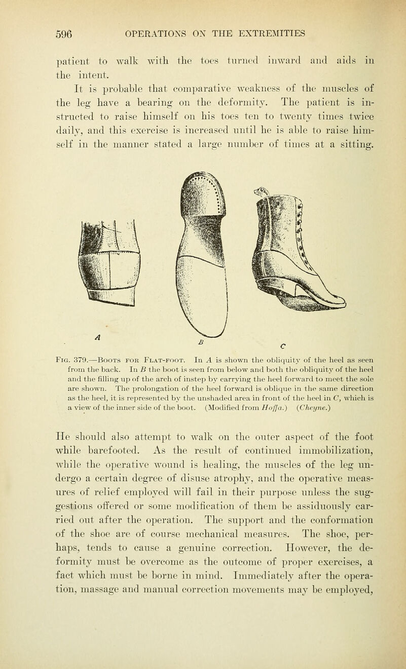 patient to walk with the toes turned inward and aids in the intent. It is probable that comparative weakness of the muscles of the leg have a bearing on the deformity. The patient is in- structed to raise himself on his toes ten to twenty times twice daily, and this exercise is increased until he is able to raise him- self in the manner stated a large number of times at a sitting. c€%. Fig. 379.—Boots for Flat-foot. In A is shown the obliquity of the heel as seen from the back. In B the boot is seen from below and both the obliquity of the heel and the filling up of the arch of instep by carrying the heel forward to meet the sole are shown. The prolongation of the heel forward is oblique in the same direction as the heel, it is represented by the unshaded area in front of the heel in C, which is a view of the inner side of the boot. (Modified from Hoffa.) (Cheyne.) He should also attempt to walk on the outer aspect of the foot while barefooted. As the result of continued immobilization, while the operative wound is healing, the muscles of the leg un- dergo a certain degree of disuse atrophy, and the operative meas- ures of relief employed will fail in their purpose unless the sug- gestions offered or some modification of them be assiduously car- ried out after the operation. The support and the conformation of the shoe are of course mechanical measures. The shoe, per- haps, tends to cause a genuine correction. However, the de- formity must be overcome as the outcome of proper exercises, a fact which must be borne in mind. Immediately after the opera- tion, massage and manual correction movements may be employed,