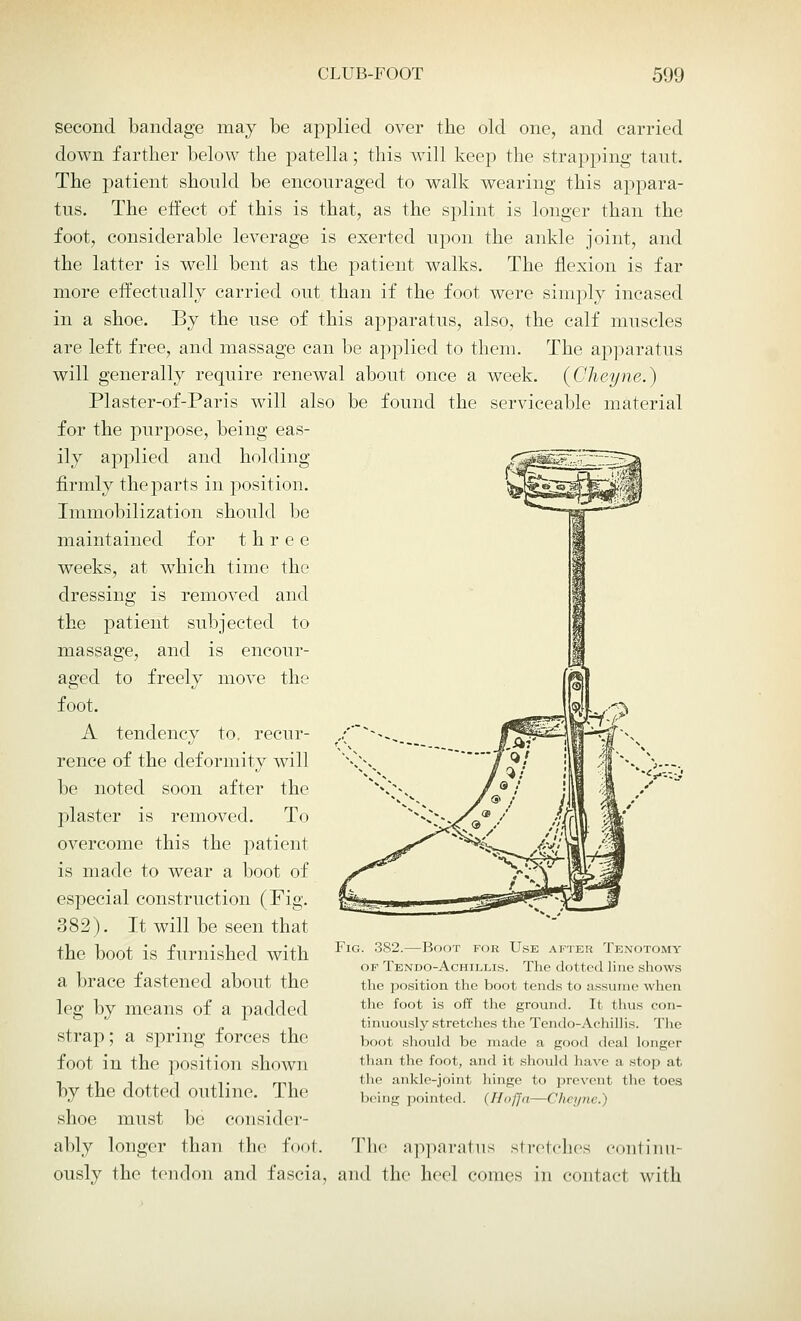 second bandage may be applied over the old one, and carried down farther below the patella; this will keep the strapping tant. The patient should be encouraged to walk wearing this appara- tus. The effect of this is that, as the splint is longer than the foot, considerable leverage is exerted upon the ankle joint, and the latter is well bent as the patient walks. The flexion is far more effectually carried out than if the foot were simply incased in a shoe. By the use of this apparatus, also, the calf muscles are left free, and massage can be applied to them. The apparatus will generally require renewal about once a week. {Cheyne.) Plaster-of-Paris will also be found the serviceable material for the purpose, being eas- ily applied and holding firmly the parts in position. Immobilization should be maintained for three weeks, at which time the dressing is removed and the patient subjected to massage, and is encour- aged to freely move the foot. A tendency to. recur- rence of the deformity will be noted soon after the plaster is removed. To overcome this the patient is made to wear a boot of especial construction (Fig. 382). It will be seen that the boot is furnished with a brace fastened about the leg by means of a padded strap; a spring forces the foot in the position shown by the dotted outline. The shoe must be consider- ably longer than the foot. The apparatus stretches continu- ously the tendon and fascia, and the heel conies in contact with Fig. 382.—Boot for Use after Tenotomy of Tendo-Achillis. The dotted line shows the position the boot tends to assume when the foot is off the ground. It thus con- tinuously stretches the Tendo-Aohillis. The boot should be made a good deal longer than the foot, and it should have a stop at the ankle-joint hinge to prevent the toes being pointed. (//<>//«—Cheyne.)