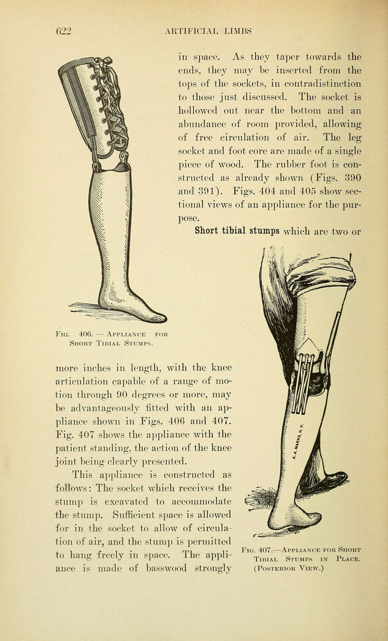 in space. As they taper towards the ends, they may be inserted from the tops of the sockets, in contradistinction to those just discussed. The socket is hollowed out near the bottom and an abundance of room provided, allowing of free circulation of air. The leg socket and foot core are made of a single piece of wood. The rubber foot is con- structed as already shown (Figs. 390 and 391). Figs. 404 and 405 show sec- tional views of an appliance for the pur- pose. Short tibial stumps which are two or Fig. 406. — Appliance for Short Tibial Stumps. more inches in length, with the knee articulation capable of a range of mo- tion through 90 degrees or more, may be advantageously fitted with an ap- pliance shown in Figs. 406 and 407. Fig. 407 shows the appliance with the patient standing, the action of the knee joint being clearly presented. This appliance is constructed as follows: The socket which receives the stump is excavated to accommodate the stump. Sufficient space is allowed for in the socket to allow of circula- tion of air, and the stump is permitted to hang freely in space. The appli- ance is made of basswood strongly Fig. 407.—Appliance for Short Tibial Stumps in Place. (Posterior View.)