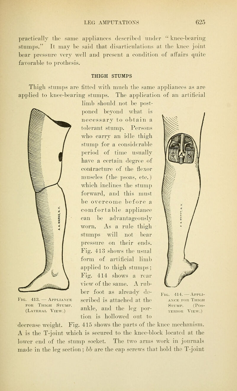 practically the same appliances described under  knee-bearing stumps. It may be said that disarticulations at the knee joint bear pressure very well and present a condition of affairs quite favorable to prothesis. THIGH STUMPS Thigh stumps are fitted with much the same appliances as are applied to knee-bearing stumps. The application of an artificial limb should not be post- poned beyond what is necessary to obtain a tolerant stump. Persons who carry an idle thigh stump for a considerable period of time usually have a certain degree of contracture of the flexor muscles (the psoas, etc.) which inclines the stump forward, and this must be overcome before a comfortable appliance can be advantageously worn. As a rule thigh stumps will not bear pressure on their ends. Fig. 413 shows the usual form of artificial limb applied to thigh stumps; Fig. 414 shows a rear view of the same. A rub- ber foot as already de- scribed is attached at the ankle, and the leg por- tion is hollowed out to 415 shows the parts of the knee mechanism. A is the T-joint which is secured to the knee-block located at the lower end of the stump socket. The two arms work in journals made in the leg section; bb are the cap screws that hold the T-joint Fig. 413. — Appliance for Thigh Stump. (Lateral View.) decrease weight. Fij Fig. 414.—Appli- ance for Thigh Stump. (Pos- terior View.)
