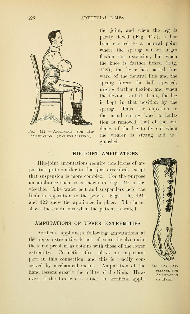 Fig. 422. — Appliance for Hip Amputation. (Patient Sitting.) the joint, and when the leg is partly flexed (Fig. 417), it has been carried to a neutral point where the spring neither urges flexion nor extension, but when the knee is farther flexed (Fig. 418), the lever has passed for- ward of the neutral line and the spring forces the ball upward, urging farther flexion, and when the flexion is at its limit, the leg is kept in that position by the spring. Thus, the objection to the usual spring knee articula- tion is removed, that of the ten- dency of the leg to fly out when the wearer is sitting and un- guarded. HIP-JOINT AMPUTATIONS Hip-joint amputations require conditions of ap- paratus quite similar to that just described, except that suspension is more complex. For the purpose an appliance such as is shown in Fig. 419 is ser- viceable. The waist belt and suspenders hold the limb in apposition to the pelvis. Figs. 420, 421, and 422 show the appliance in place. The latter shows the conditions when the patient is seated. AMPUTATIONS OF UPPER EXTREMITIES Artificial appliances following amputations at the upper extremities do not, of couse, involve quite the same problem as obtains with those of the lower extremity. Cosmetic effect plays an important part in this connection, and this is readily con- served by mechanical means. Amputation of the hand lessens greatly the utility of the limb. How- ever, if the forearm is intact, an artificial appli- Fig. 423.—Ap- pliance FOR Amputation of Hand.