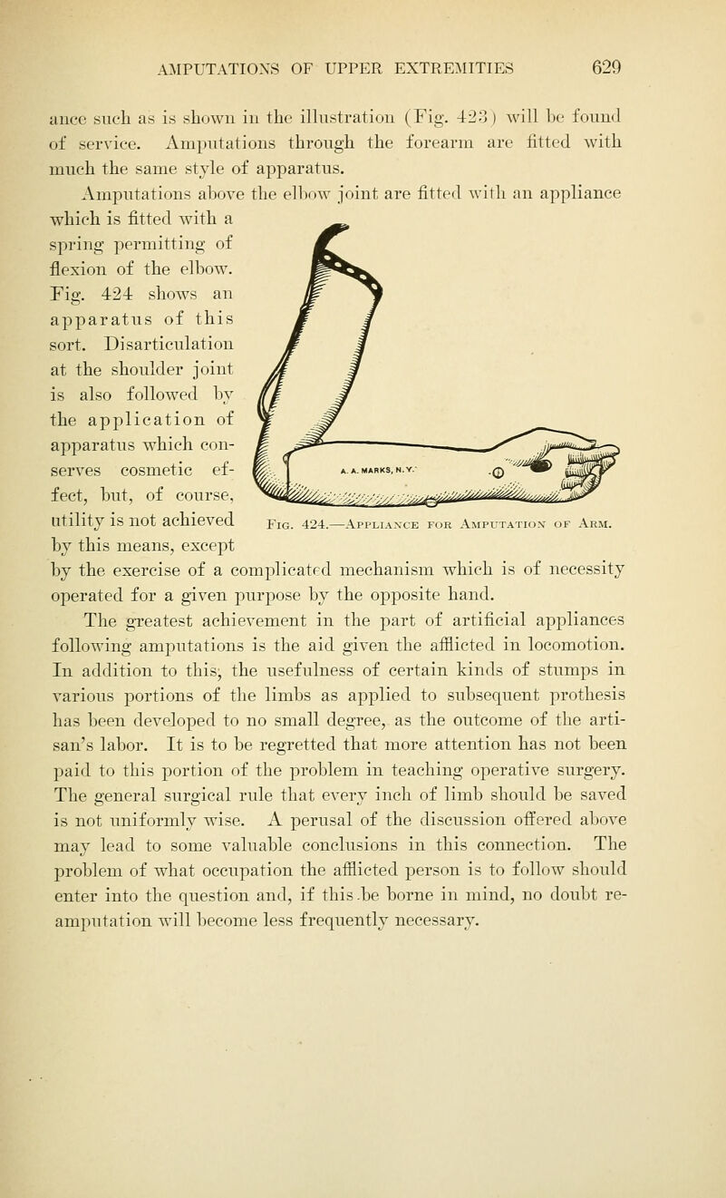 ance such as is shown in the illustration (Fig. 423) will be found of service. Amputations through the forearm are fitted with much the same style of apparatus. Amputations above the elbow joint are fitted with an appliance which is fitted with a spring permitting of flexion of the elbow. Fig. 424 shows an apparatus of this sort. Disarticulation at the shoulder joint is also followed by the application of apparatus which con- serves cosmetic ef- fect, but, of course, utility is not achieved by this means, except by the exercise of a complicated mechanism which is of necessity operated for a given purpose by the opposite hand. The greatest achievement in the part of artificial appliances following amputations is the aid given the afflicted in locomotion. In addition to this, the usefulness of certain kinds of stumps in various portions of the limbs as applied to subsequent prothesis has been developed to no small degree, as the outcome of the arti- san's labor. It is to be regretted that more attention has not been paid to this portion of the problem in teaching operative surgery. The general surgical rule that every inch of limb should be saved is not uniformly wise. A perusal of the discussion offered above may lead to some valuable conclusions in this connection. The problem of what occupation the afflicted person is to follow should enter into the question and, if this.be borne in mind, no doubt re- amputation will become less frequently necessary. Fig. 424.—Appliance for Amputation' of Arm.