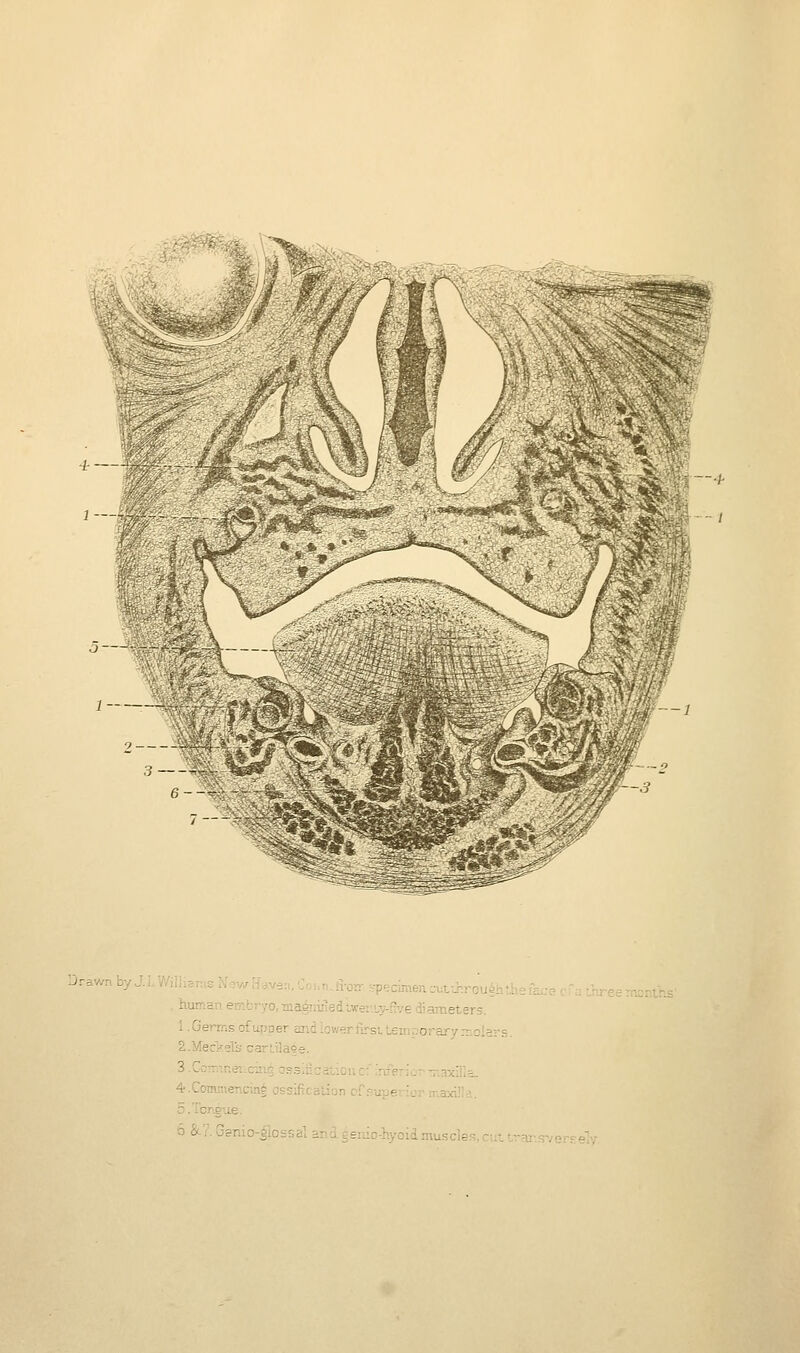 Drawn by J.L Wiiliaras ^fcw [lave:., Coi.n.ti-orr specimen cut-J;roui.: , human embryo, ■ma^jiijied.lifei'.iy-five diameters. 1 .Germs of upper and lov>-'•'■;• '.-:■ ••'.' <--- S.Mecksls carLila5e. 3.Ccrm.neiiciiig o.^-siiiCdL-v-:.: .l- ... -;--x!:.- 4.Commencing ossification of superior niaxi!!.'. 5 .Tongxie. 6 &?. Gsnio-|lossal and gemo-hyoid muscles, cut trar.i?verselv