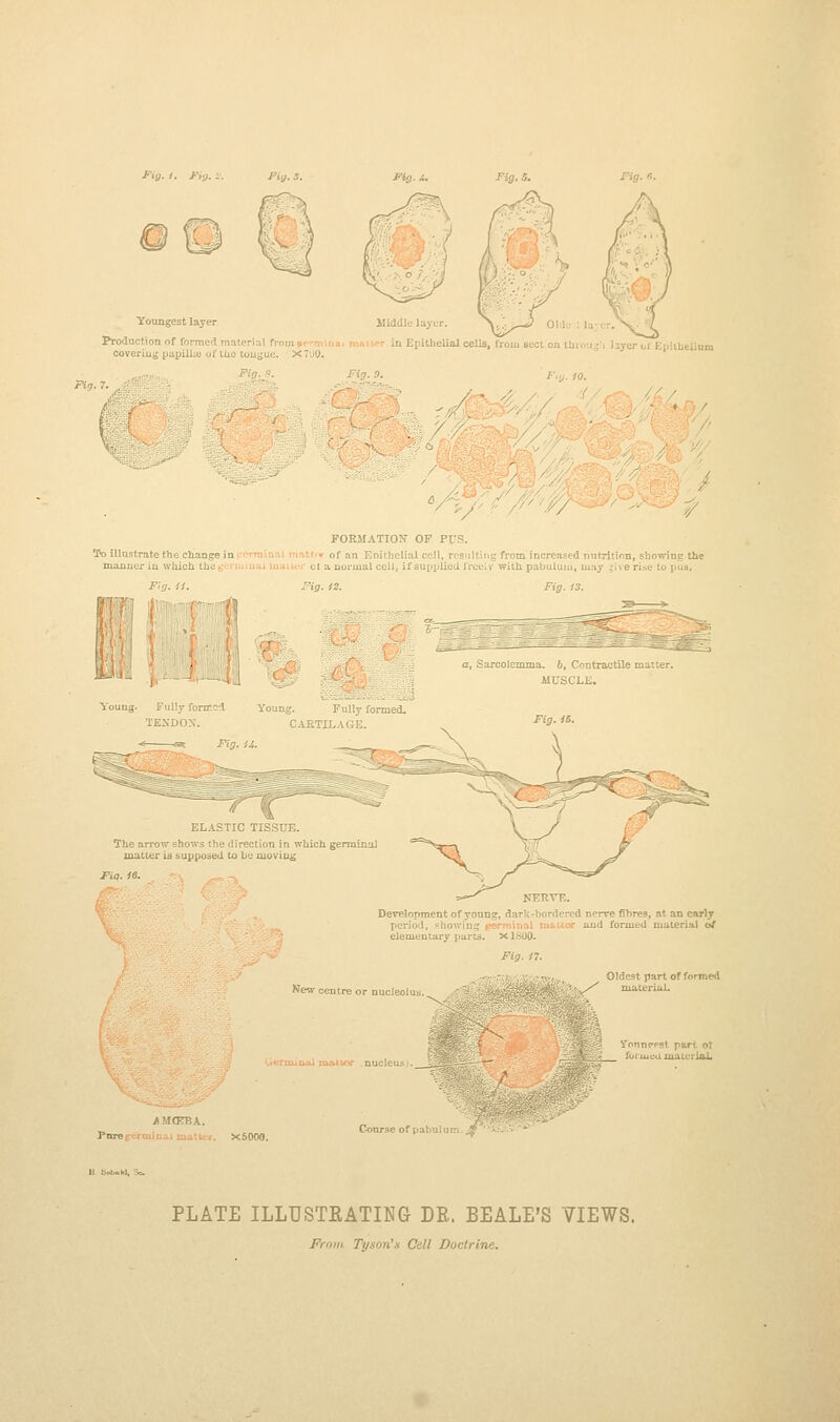 Fig. /. Fig. : Pig. 3. Toungest layer Production of formed material from -. ooveriug papilla of the tougue. x: Jng-I^ Fig. S. Fig. «. Middle layer. > ^^ OhK ■n Epithelial cells, from sect on tliroa;'i layer oriipiiheliun / ;. ■/ /■V/-'^ - ? FORMATION OF PUS. To illustrate the change in (-'crrainal matt'» of an Eoithelial cell, resulting from increased nntrition, showing the manner in wliich the (jeriuiuai muiUM' ct a normal cell, if supplied li-eelv with pabulum, may jive rise to pus. Fig. U. Fig. 13. ■I |f||fli|| aa > Young. Fully formed Young. j- uuy i TENDON. CARTILAGE. Fig. ii. Fig. IB. ELASTIC TISSUE. The arrow shows the direction in which germinal matter is supposed Ui be zuoviug Development of young, dark-bordered nerve fibres, at an early period, showing permiiial inauor and formed material of elementary parts. X1800. New centre or nucleolu Oldest part of formed ^ material. i^ermiiuii joMtor .nucleusj. Pore X5000. Course of pabu; i: ly. * PLATE ILLUSTKATING DR. BEALE'S VIEWS. From Tyson'.s Cell Doctrine.