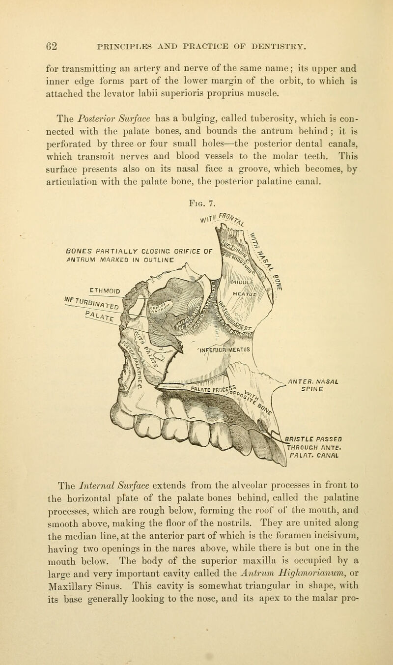 for transmitting an artery and nerve of tlie same name; its upper and inner edge forms part of the lower margin of the orbit, to which is attached the levator labii superioris proprius muscle. The Posterior Surface has a bulging, called tuberosity, which is con- nected w^ith the palate bones, and bounds the antrum behind ; it is perforated by three or four small holes—the posterior dental canals, which transmit nerves and blood vessels to the molar teeth. This surface presents also on its nasal face a groove, which becomes, by articulation with the palate bone, the posterior palatine canal. Fig. 7. BONES PART/ALi-V C/.OSINC ORIFICE OF A!\iTRUM MARKCD IN OUTLINE ':^(?/i^> ANTER. NASAL SPINE BRISTLE PASSED rHROUCH ANTE. P/ILAT. CANAL The Internal Surface extends from the alveolar processes in front to the horizontal plate of the palate bones behind, called the palatine processes, which are rough below, forming the roof of the mouth, and smooth above, making the floor of the nostrils. They are united along the median line, at the anterior part of which is the foramen incisivum, having two openings in the nares above, while there is but one in the mouth below. The body of the superior maxilla is occupied by a large and very important cavity called the Antrum Highmorianum, or Maxillary Sinus. This cavity is somewhat triangular in shape, with its base generally looking to the nose, and its apex to the malar pro-