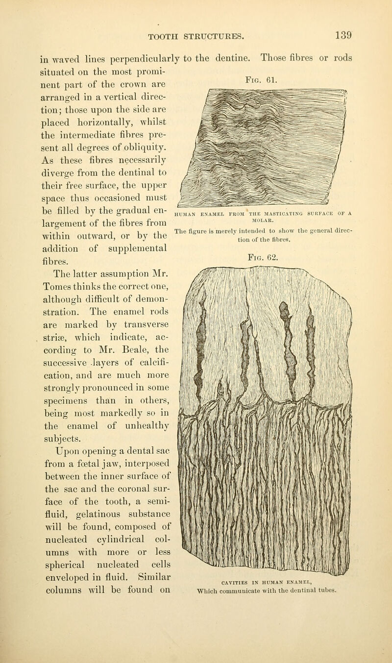 in waved lines perpendicularly to the dentine situated on the most promi- nent part of the crown are arranged in a vertical direc- tion ; those upon the side are placed horizontally, whilst the intermediate fibres pre- sent all degrees of obliquity. As these fibres necessarily diverge from the dentinal to their free surface, the upper space thus occasioned must be filled by the gradual en- largement of the fibres from within outward, or by the addition of supplemental fibres. The latter assumption Mr. Tomes thinks the correct one, although difficult of demon- stration. The enamel rods are marked by transverse striae, which indicate, ac- cording to Mr. Beale, the successive .layers of calcifi- cation, and are much more strongly pronounced in some specimens than in others, being most markedly so in the enamel of unhealthy subjects. Upon opening a dental sac from a foetal jaw, interposed between the inner surface of the sac and the coronal sur- face of the tooth, a semi- fluid, gelatinous substance will be found, composed of nucleated cylindrical col- umns with more or less spherical nucleated cells enveloped in fluid. Similar columns will be found on Those fibres or rods Fig. HLMAiN LNAMhl, I ROM IHC JIASlltAltM, SURFACE OP A MOLAK. The figure is merely intended to show the general direc- tion of the fibres. CAVITIES IN HUMAN EIsAMEL, Which communicate with the dentinal tubes.