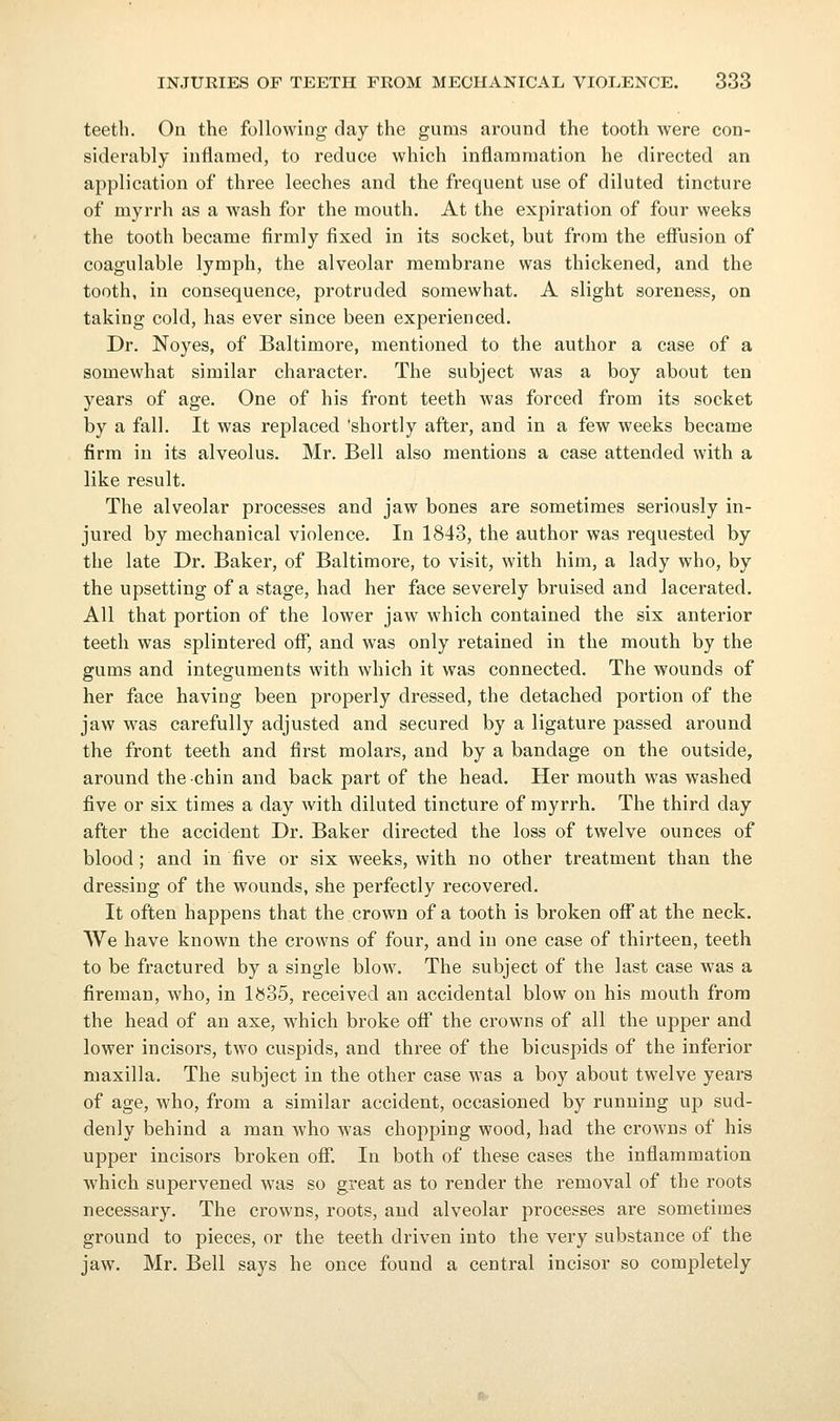 teetli. On the following day the gums around the tooth were con- siderably inflamed, to reduce which inflammation he directed an application of three leeches and the frequent use of diluted tincture of myrrh as a wash for the mouth. At the expiration of four weeks the tooth became firmly fixed in its socket, but from the eflTusion of coagulable lymph, the alveolar membrane was thickened, and the tooth, in consequence, protruded somewhat. A slight soreness, on taking cold, has ever since been experienced. Dr. Noyes, of Baltimore, mentioned to the author a case of a somewhat similar character. The subject was a boy about ten years of age. One of his front teeth was forced from its socket by a fall. It was replaced 'shortly after, and in a few weeks became firm in its alveolus. Mr. Bell also mentions a case attended with a like result. The alveolar processes and jaw bones are sometimes seriously in- jured by mechanical violence. In 1843, the author was requested by the late Dr. Baker, of Baltimore, to visit, with him, a lady who, by the upsetting of a stage, had her face severely bruised and lacerated. All that portion of the lower jaw which contained the six anterior teeth was splintered off, and was only retained in the mouth by the gums and integuments with which it was connected. The wounds of her face having been properly dressed, the detached portion of the jaw was carefully adjusted and secured by a ligature passed around the front teeth and first molars, and by a bandage on the outside, around the chin and back part of the head. Her mouth was washed five or six times a day with diluted tincture of myrrh. The third day after the accident Dr. Baker directed the loss of twelve ounces of blood; and in five or six weeks, with no other treatment than the dressing of the wounds, she perfectly recovered. It often happens that the crown of a tooth is broken off at the neck. We have known the crowns of four, and in one case of thirteen, teeth to be fractured by a single blow. The subject of the last case was a fireman, who, in 1^535, received an accidental blow on his mouth from the head of an axe, which broke off the crowns of all the upper and lower incisors, two cuspids, and three of the bicuspids of the inferior maxilla. The subject in the other case was a boy about twelve years of age, who, from a similar accident, occasioned by running up sud- denly behind a man who was chopping wood, had the crowns of his upper incisors broken ofi. In both of these cases the inflammation which supervened was so great as to render the removal of the roots necessary. The crowns, roots, and alveolar processes are sometimes ground to pieces, or the teeth driven into the very substance of the jaw. Mr. Bell says he once found a central incisor so completely