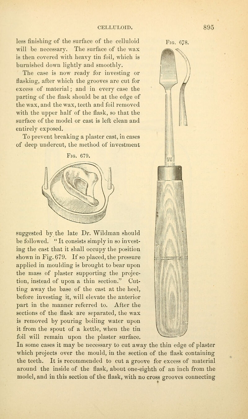 less finishing of the surface of the celluloid will be necessary. The surface of the wax is then covered with heavy tin foil, which is burnished down lightly and smoothly. The case is now ready for investing or flaskiug, after which the grooves are cut for excess of material; and in every case the parting of the flask should be at the edge of the wax, and the wax, teeth and foil removed with the upper half of the flask, so that the surface of the model or cast is left clean and entirely exposed. To prevent breaking a plaster cast, in cases of deep undercut, the method of investment Fig. 679. Fig. 678. iml suggested by the late Dr. Wildman should be followed.  It consists simply in so invest- ing the cast that it shall occupy the position shown in Fig. 679. If so placed, the pressure applied in moulding is brought to bear upon the mass of plaster supporting the projec- tion, instead of upon a thin section. Cut- ting away the base of the cast at the heel, before investing it, will elevate the anterior part in the manner referred to. After the sections of the flask are separated, the wax is removed by pouring boiling water upon it from the spout of a kettle, when the tin foil will remain upon the plaster surface. In some cases it may be necessary to cut away the thin edge of plaster which projects over the mould, in the section of the flask containing the teeth. It is recommended to cut a groove for excess of material around the inside of the flask, about one-eighth of an inch from the model, and in this section of the flask, with no cross grooves connecting