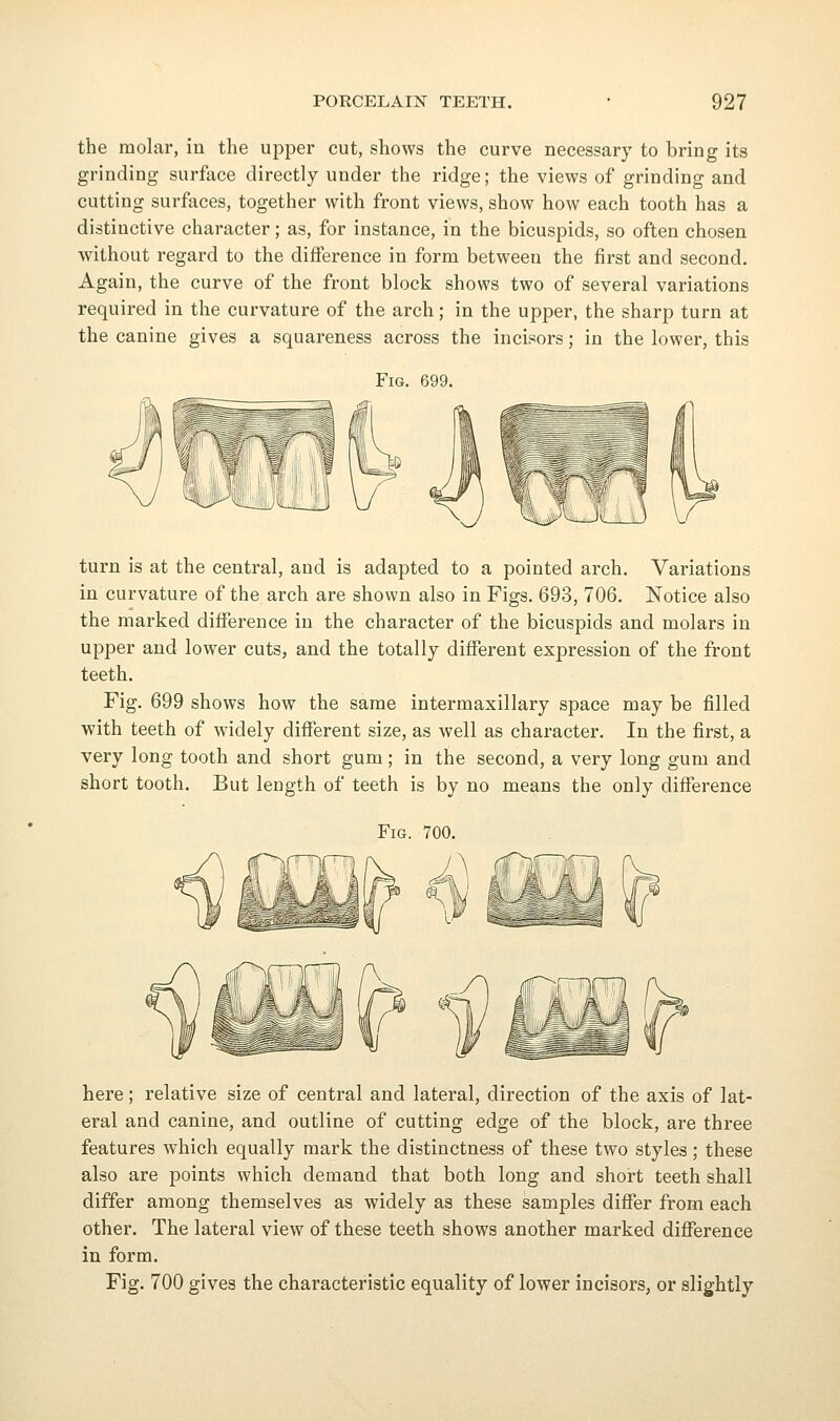 the molar, in the upper cut, shows the curve necessary to bring its grinding surface directly under the ridge; the views of grinding and cutting surfaces, together with front views, show how each tooth has a distinctive character; as, for instance, in the bicuspids, so often chosen without regard to the difference in form between the first and second. Again, the curve of the front block shows two of several variations required in the curvature of the arch; in the upper, the sharp turn at the canine gives a squareness across the incisors; in the lower, this Fig. 699. turn is at the central, and is adapted to a pointed arch. Variations in curvature of the arch are shown also in Figs. 693, 706. Notice also the marked difference in the character of the bicuspids and molars in upper and lower cuts, and the totally different expression of the front teeth. Fig. 699 shows how the same intermaxillary space may be filled with teeth of widely different size, as well as character. In the first, a very long tooth and short gum; in the second, a very long gum and short tooth. But length of teeth is by no means the only difference Fig. 700. here; relative size of central and lateral, direction of the axis of lat- eral and canine, and outline of cutting edge of the block, are three features which equally mark the distinctness of these two styles ; these also are points which demand that both long and short teeth shall differ among themselves as widely as these samples differ from each other. The lateral view of these teeth shows another marked difl^erence in form. Fig. 700 gives the characteristic equality of lower incisors, or slightly