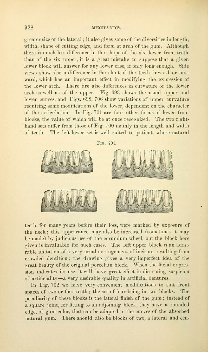 greater size of the lateral; it also gives some of the diversities in length, width, shape of cutting edge, and form at arch of the gum. Although there is much less difference in the shape of the six lower front teeth than of the six upper, it is a great mistake to suppose that a given lower block will answer for any lower case, if only long enough. Side views show also a difference in the slant of the teeth, inward or out- ward, which has an important effect in modifying the expression of the lower arch. There are also differences in curvature of the lower arch as well as of the upper. Fig. 693 shows the usual upper and lower curves, and Figs. 698, 706 show variations of upper curvature requiring some modifications of the lower, dependent on the character of the articulation. In Fig. 701 are four other forms of lower front blocks, the value of which will be at once recognized. The two right- hand sets differ from those of Fig. 700 mainly in the length and width of teeth. The left lower set is well suited to patients whose natural Fig. 701. teeth, for many years before their loss, were marked by exposure of the neck; this appearance may also be increased (sometimes it may be made) by judicious use of the corundum wheel, but the block here given is invaluable for such cases. The left upper block is an admi- rable imitation of a very usual arrangement of incisors, resulting from crowded dentition; the drawing gives a very imperfect idea of the great beauty of the original porcelain block. When the facial expres- sion indicates its use, it will have great effect in disarming suspicion of artificiality—a very desirable quality in artificial dentures. In Fig. 702 we have very convenient modifications to suit front spaces of two or four teeth ; the set of four being in two blocks. The peculiarity of these blocks is the lateral finish of the gum; instead of a square joint, for fitting to an adjoining block, they have a rounded edge, of gum color, that can be adapted to the curves of the absorbed natural gum. There should also be blocks of two, a lateral and cen-