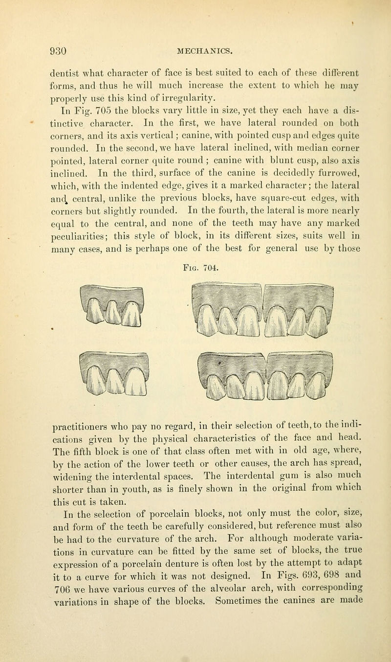 dentist what character of face is best suited to each of these different forms, and thus he will much increase the extent to which he may properly use this kind of irregularity. In Fig. 705 the blocks vary little in size, yet they each have a dis- tinctive character. In the first, we have lateral rounded on both corners, and its axis vertical; canine, with pointed cusp and edges quite rounded. In the second, we have lateral inclined, with median corner pointed, lateral corner quite round ; canine with blunt cusp, also axis inclined. In the third, surface of the canine is decidedly furrowed, which, with the indented edge, gives it a marked character; the lateral and^ central, unlike the previous blocks, have square-cut edges, with corners but slightly rounded. In the fourth, the lateral is more nearly equal to the central, and none of the teeth may have any marked peculiarities; this style of block, in its different sizes, suits well in many cases, and is perhaps one of the best for general use by those Fig. 704. practitioners who pay no regard, in their selection of teeth, to the indi- cations given by the physical characteristics of the face and head. The fifth block is one of that class often met with in old age, where, by the action of the lower teeth or other causes, the arch has spread, widening the interdental spaces. The interdental gum is also much shorter than in youth, as is finely shown in the original from which this cut is taken. In the selection of porcelain blocks, not only must the color, size, and form of the teeth be carefully considered, but reference must also be had to the curvature of the arch. For although moderate varia- tions in curvature can be fitted by the same set of blocks, the true expression of a porcelain denture is often lost by the attempt to adapt it to a curve for which it was not designed. In Figs. 693, 698 and 706 we have various curves of the alveolar arch, with corresponding variations in shape of the blocks. Sometimes the canines are made