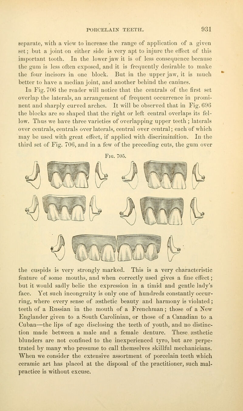 separate, with a view to increase the range of application of a given set; but a joint on either side is very apt to injure the effect of this important tooth. In the lower jaw it is of less consequence because the gum is less often exposed, and it is frequently desirable to make the four incisors in one block. But in the upper jaw, it is much better to have a median joint, and another behind the canines. In Fig. 706 the reader will notice that the centrals of the first set overlap the laterals, an arrangement of frequent occurrence in promi- nent and sharply curved arches. It will be observed that in Fig. 696 the blocks are so shaped that the right or left central overlaps its fel- low. Thus we have three varieties of overlapping upper teeth ; laterals over centrals, centrals over laterals, central over central; each of which may be used with great effect, if applied with discrimination. In the third set of Fig, 706, and in a few of the preceding cuts, the gum over Fig. 705. the cuspids is very strongly marked. This is a very characteristic feature of some mouths, and when correctly used gives a fine effect; but it would sadly belie the expression in a timid and gentle lady's face. Yet such incongruity is only one of hundreds constantly occur- ring, where every sense of sesthetic beauty and harmony is violated; teeth of a Russian in the mouth of a Frenchman; those of a New Englander given to a South Carolinian, or those of a Canadian to a Cuban—the lips of age disclosing the teeth of youth, and no distinc- tion made between a male and a female denture. These sesthetic blunders are not confined to the inexperienced tyro, but are perpe- trated by many who presume to call themselves skillful mechanicians. When we consider the extensive assortment of porcelain teeth which ceramic art has placed at the disposal of the practitioner, such mal- practice is without excuse.