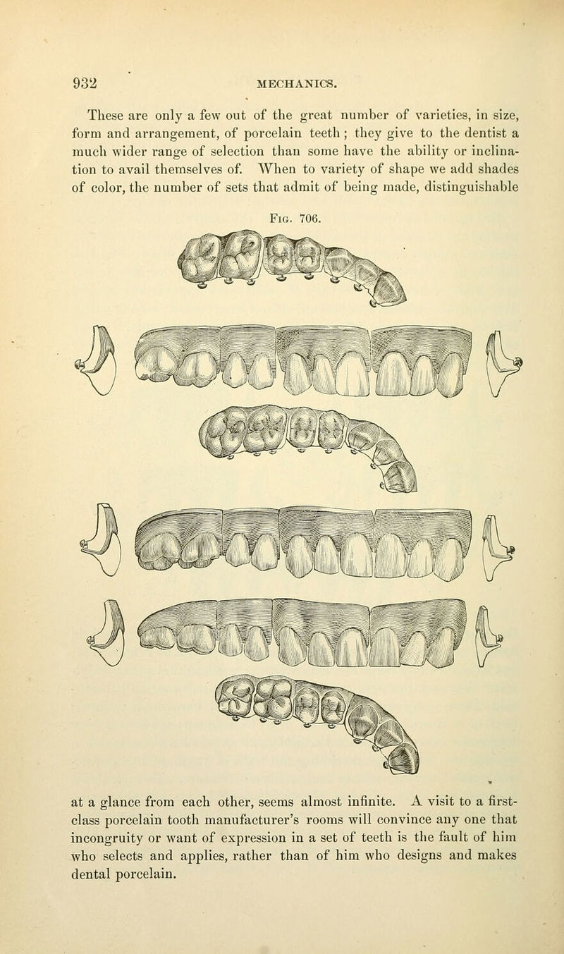 These are only a few out of the great number of varieties, in size, form and arrangement, of porcelain teeth ; they give to the dentist a much wider range of selection than some have the ability or inclina- tion to avail themselves of When to variety of shape we add shades of color, the number of sets that admit of being made, distinguishable Fig. 706. ■-<a^ ^ ^ W '>-' ^ at a glance from each other, seems almost infinite. A visit to a first- class porcelain tooth manufacturer's rooms will convince any one that incongruity or want of expression in a set of teeth is the fault of him who selects and applies, rather than of him who designs and makes dental porcelain.