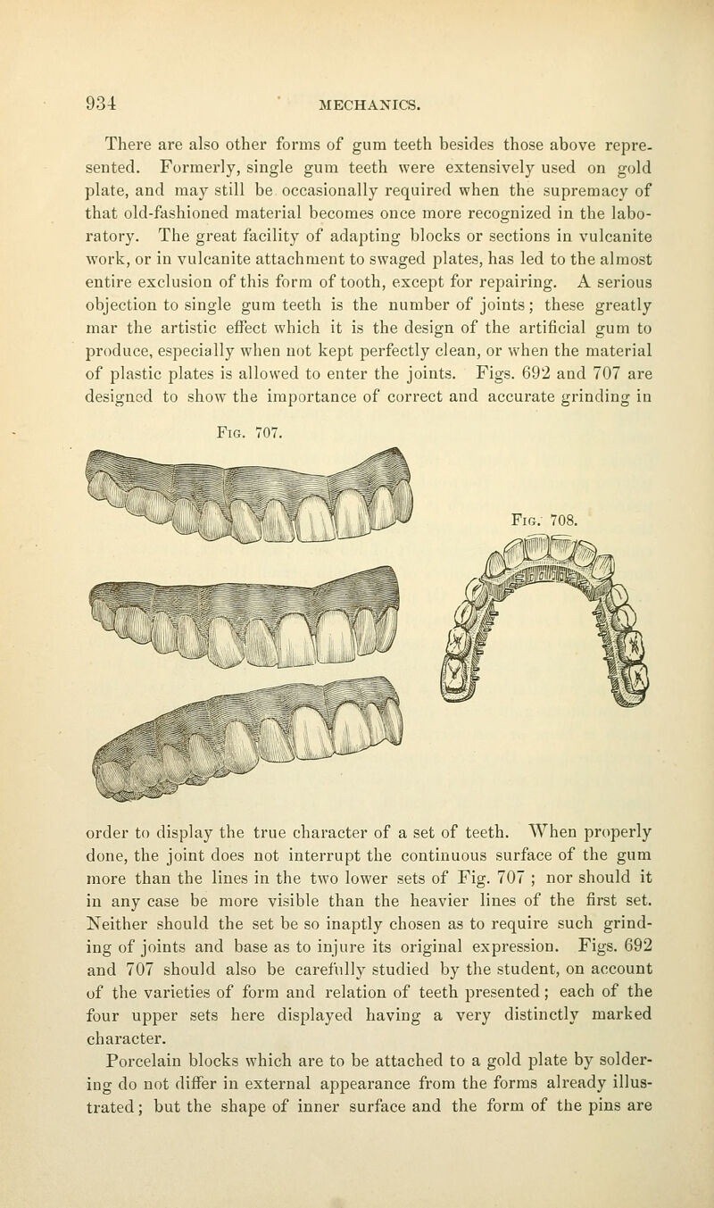 There are also other forms of gum teeth besides those above repre- sented. Formerly, single gum teeth were extensively used on gold plate, and may still be occasionally required when the supremacy of that old-fashioned material becomes once more recognized in the labo- ratory. The great facility of adapting blocks or sections in vulcanite work, or in vulcanite attachment to swaged plates, has led to the almost entire exclusion of this form of tooth, except for repairing. A serious objection to single gum teeth is the number of joints; these greatly mar the artistic effect which it is the design of the artificial gum to produce, especially when not kept perfectly clean, or when the material of plastic plates is allowed to enter the joints. Figs. 692 and 707 are designed to show the importance of correct and accurate grinding in Fig. 707. order to display the true character of a set of teeth. When properly done, the joint does not interrupt the continuous surface of the gum more than the lines in the two lower sets of Fig. 707 ; nor should it in any case be more visible than the heavier lines of the first set. Neither should the set be so inaptly chosen as to require such grind- ing of joints and base as to injure its original expression. Figs. 692 and 707 should also be carefully studied by the student, on account of the varieties of form and relation of teeth presented; each of the four upper sets here displayed having a very distinctly marked character. Porcelain blocks which are to be attached to a gold plate by solder- ing do not differ in external appearance from the forms already illus- trated ; but the shape of inner surface and the form of the pins are