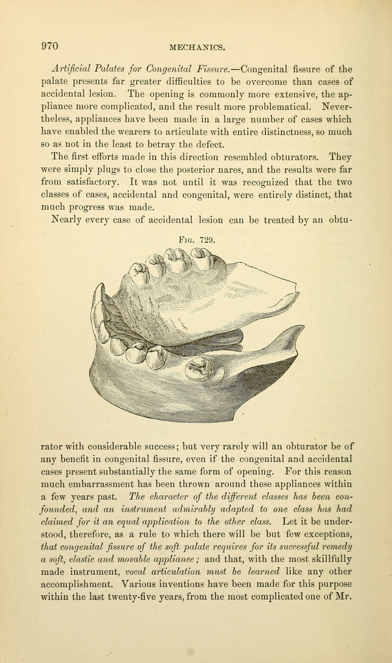 Artificial Palates for Congenital Fissure.—Congenital fissure of the palate presents far greater difficulties to be overcome than cases of accidental lesion. The opening is commonly more extensive, the ap- pliance more complicated, and the result more problematical. Never- theless, appliances have been made in a large number of cases which have enabled the wearers to articulate with entire distinctness, so much so as not in the least to betray the defect. The first efforts made in this direction resembled obturators. They were simply plugs to close the posterior nares, and the results were far from satisfactory. It was not until it was recognized that the two classes of cases, accidental and congenital, were entirely distinct, that much progress was made. Nearly every case of accidental lesion can be treated by an obtu- FlG, rator with considerable success; but very rarely will an obturator be of any benefit in congenital fissure, even if the congenital and accidental cases present substantially the same form of opening. For this reason much embarrassment has been thrown around these appliances within a few years past. The character of the different classes has been con- founded, and an instrument admirably adapted to one class has had claimed for it an equal application to the other class. Let it be under- stood, therefore, as a rule to which there will be but few exceptions, that congenital fissure of the soft palate requires for its successful remedy a soft, elastic and movable appliance; and that, with the most skillfully made instrument, vocal articulation must be learned like any other accomplishment. Various inventions have been made for this purpose within the last twenty-five years, from the most complicated one of Mr.