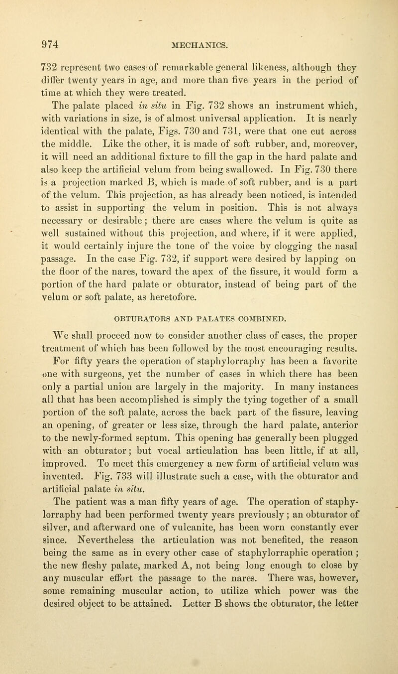 732 represent two cases of remarkable general likeness, although they differ twenty years in age, and more than five years in the period of time at which they were treated. The palate placed in situ in Fig. 732 shows an instrument which, with variations in size, is of almost universal application. It is nearly identical with the palate, Figs. 730 and 731, were that one cut across the middle. Like the other, it is made of soft rubber, and, moreover, it will need an additional fixture to fill the gap in the hard palate and also keep the artificial velum from being swallowed. In Fig. 730 there is a projection marked B, which is made of soft rubber, and is a part of the velum. This projection, as has already been noticed, is intended to assist in supporting the velum in position. This is not always necessary or desirable; there are cases where the velum is quite as well sustained without this projection, and where, if it were applied, it would certainly injure the tone of the voice by clogging the nasal passage. In the case Fig. 732, if support were desired by lapping on the floor of the nares, toward the apex of the fissure, it would form a portion of the hard palate or obturator, instead of being part of the velum or soft palate, as heretofore. OBTURATORS AND PALATES COMBINED. We shall proceed now to consider another class of cases, the proper treatment of which has been followed by the most encouraging results. For fifty years the operation of staphylorraphy has been a favorite one with surgeons, yet the number of cases in which there has been only a partial union are largely in the majority. In many instances all that has been accomplished is simply the tying together of a small portion of the soft palate, across the back part of the fissure, leaving an opening, of greater or less size, through the hard palate, anterior to the newly-formed septum. This opening has generally been plugged with an obturator; but vocal articulation has been little, if at all, improved. To meet this emergency a new form of artificial velum was invented. Fig. 733 will illustrate such a case, with the obturator and artificial palate in situ. The patient was a man fifty years of age. The operation of staphy- lorraphy had been performed twenty years previously ; an obturator of silver, and afterward one of vulcanite, has been worn constantly ever since. Nevertheless the articulation was not benefited, the reason being the same as in every other case of staphylorraphic operation ; the new fleshy palate, marked A, not being long enough to close by any muscular efibrt the passage to the nares. There was, however, some remaining muscular action, to utilize which power was the desired object to be attained. Letter B shows the obturator, the letter