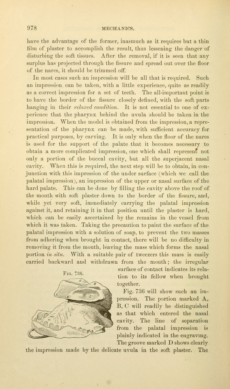 have the advantage of the former, inasmuch as it requires but a thin film of plaster to accomplish the result, thus lessening the danger of disturbing the soft tissues. After the removal, if it is seen that any surplus has projected through the fissure and spread out over the floor of the nares, it should be trimmed off. In most cases such an impression will be all that is required. Such an impression can be taken, with a little experience, quite as readily as a correct impression for a set of teeth. The all-iraportaut point is to have the border of the fissure closely defined, with the soft parts hanging in their relaxed condition. It is not essential to one of ex- perience that the pharynx behind the uvula should be taken in the impression. When the model is obtained from the impression, a repre- sentation of the pharynx can be made, with sufficient accuracy for practical purposes, by carving. It is only when the floor of the nares is used for the support of the palate that it becomes necessary to obtain a more complicated impression, one which shall represent not only a portion of the buccal cavity, but all the superjacent nasal cavity. When this is required, the next step will be to obtain, in con- junction with this impression of the under surface (which we call the palatal impression), an impression of the upper or nasal surface of the hard palate. This can be done by filling the cavity above the roof of the mouth with soft plaster down to the border of the fissure, and, while yet very soft, immediately carrying the palatal impression against it, and retaining it in that position until the plaster is hard, which can be easily ascertained by the remains in the vessel from which it was taken. Taking the precaution to paint the surface of the palatal impression with a solution of soap, to prevent the two masses from adhering when brought in contact, there will be no difficulty in removing it from the mouth, leaving the mass which forms the nasal portion in situ. With a suitable pair of tweezers this mass is easily carried backward and withdrawn from the mouth; the irregular surface of contact indicates its rela- tion to its fellow when brought together. Fig. 736 will show such an im- pression. The portion marked A, B, C will readily be distinguished as that which entered the nasal cavity. The line of separation from the palatal impression is plainly indicated in the engraving. The groove marked D shows clearly the impression made by the delicate uvula in the soft plaster. The