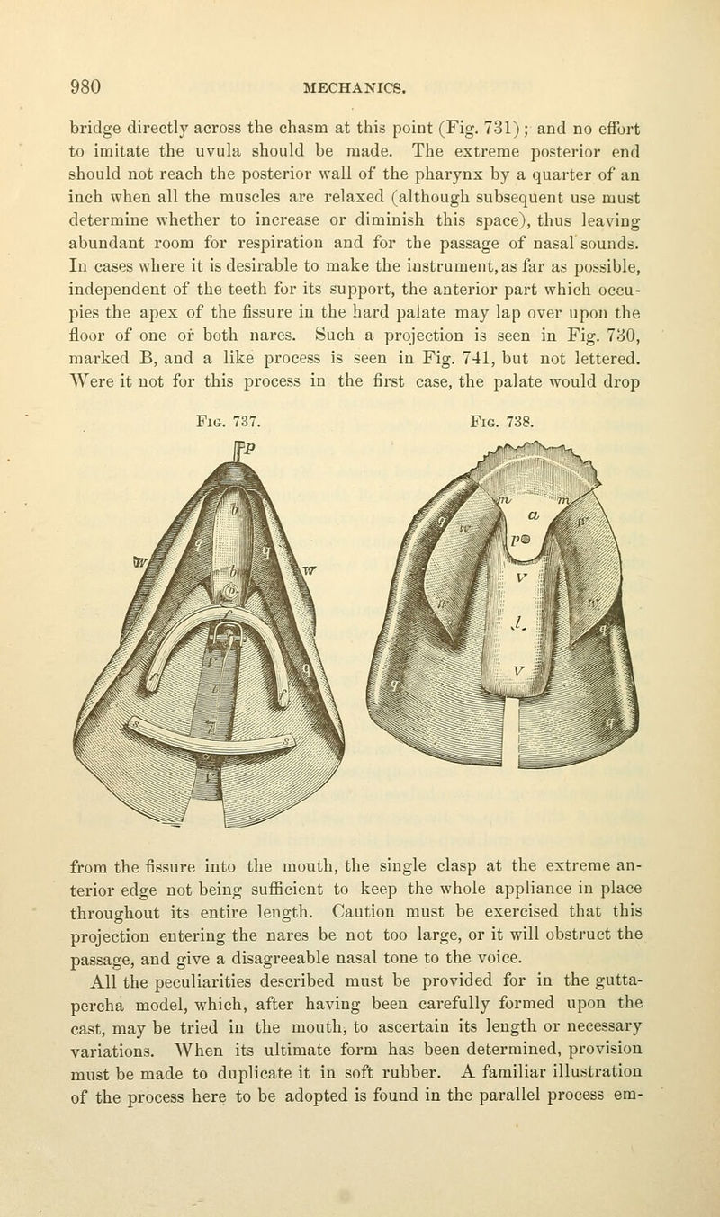 bridge directly across the chasm at this point (Fig. 731); and no effort to imitate the uvula should be made. The extreme posterior end should not reach the posterior wall of the pharynx by a quarter of an inch when all the muscles are relaxed (although subsequent use must determine whether to increase or diminish this space), thus leaving abundant room for respiration and for the passage of nasal sounds. In cases where it is desirable to make the instrument, as far as possible, independent of the teeth for its support, the anterior part which occu- pies the apex of the fissure in the hard palate may lap over upon the floor of one or both nares. Such a projection is seen in Fig. 730, marked B, and a like process is seen in Fig. 741, but not lettered. Were it not for this process in the first case, the palate would drop Fig. 737. Fig. 738. from the fissure into the mouth, the single clasp at the extreme an- terior edge not being sufficient to keep the whole appliance in place throughout its entire length. Caution must be exercised that this projection entering the nares be not too large, or it will obstruct the passage, and give a disagreeable nasal tone to the voice. All the peculiarities described must be provided for in the gutta- percha model, which, after having been carefully formed upon the cast, may be tried in the mouth, to ascertain its length or necessary variations. When its ultimate form has been determined, provision must be made to duplicate it in soft rubber. A familiar illustration of the process here to be adopted is found in the parallel process em-