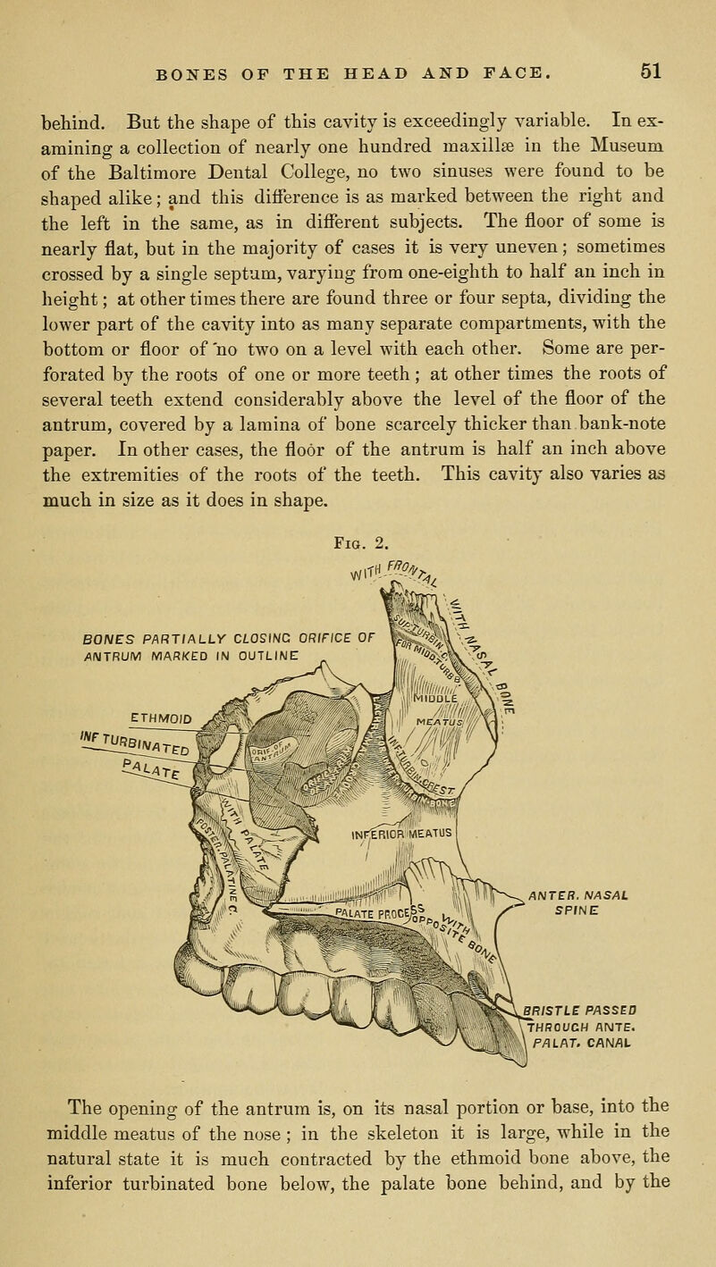 behind. But the shape of this cavity is exceedingly variable. In ex- amining a collection of nearly one hundred maxillae in the Museum of the Baltimore Dental College, no two sinuses were found to be shaped alike; and this difference is as marked between the right and the left in the same, as in different subjects. The floor of some is nearly flat, but in the majority of cases it is very uneven; sometimes crossed by a single septum, varying from one-eighth to half an inch in height; at other times there are found three or four septa, dividing the lower part of the cavity into as many separate compartments, with the bottom or floor of no two on a level with each other. Some are per- forated by the roots of one or more teeth; at other times the roots of several teeth extend considerably above the level of the floor of the antrum, covered by a lamina of bone scarcely thicker than bank-note paper. In other cases, the floor of the antrum is half an inch above the extremities of the roots of the teeth. This cavity also varies as much in size as it does in shape. BONES P/\RTIALLY CLOS\NC ORIFICE OF iAIMTRUM MARKED IN OUTLINE ANTER. NASAL SPINE BRISTLE PASSED THROUGH ANTE. PAL AT. CANAL The opening of the antrum is, on its nasal portion or base, into the middle meatus of the nose ; in the skeleton it is large, while in the natural state it is much contracted by the ethmoid bone above, the inferior turbinated bone below, the palate bone behind, and by the