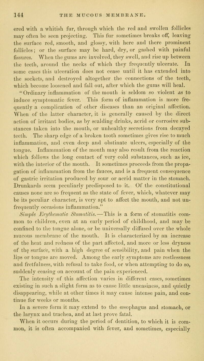 ered with a -whitish fur, through wliich the red and swollen follicles may often be seen projecting. This fur sometimes breaks off, leaving the surface red, smooth, and glossy, with here and there prominent follicles; or the surface may be hard, dry, or gashed with painful fissures. Wlien the gums are involved, they swell, and rise up between the teeth, around the necks of which they frequently ulcerate. In some cases this ulceration does not cease until it has extended into the sockets, and destroyed altogether the connections of the teeth, which become loosened and fall out, after which the gums will heal. Ordinary inflammation of the mouth is seldom so violent as to induce symptomatic fever. This form of inflammation is more fre- quently a complication of other diseases than an original affection. When of the latter character, it is generally caused by the direct action of irritant bodies, as by scalding drinks, acrid or corrosive sub- stances taken into the mouth, or unhealthy secretions from decayed teeth. The sharp edge of a broken tooth sometimes gives rise to much inflammation, and even deep and obstinate ulcers, especially of the tongue. Inflammation of the mouth may also result from the reaction which follows the long contact of very cold substances, such as ice, with the interior of the mouth. It sometimes proceeds from the propa- gation of inflammation from the fauces, and is a frequent consequence of gastric irritation produced by sour or acrid matter in the stomach. Drunkards seem peculiarly predisposed to it. Of the constitutional causes none are so frequent as the state of fever, which, whatever may be its peculiar character, is very apt to affect the mouth, and not un- frequently occasions inflammation. Simjile Erythematic Stomatitis.—This is a form of stomatitis com- mon to children, even at an early period of childhood, and may be confined to the tongue alone, or be universally diffused over the whole mucous membrane of the mouth. It is characterized by an increase of the heat and redness of the part affected, and more or less dryness of the surface, with a high degree of sensibility, and pain when the lips or tongue are moved. Among the early symptoms are restlessness and fretfulness, with refusal to take food, or when attempting to do so, suddenly ceasing on account of the pain experienced. The intensity of this affection varies in different cases, sometimes existing in such a slight form as to cause little uneasiness, and quietly disappearing, while at other times it may cause intense pain, and con- tinue for Aveeks or months. In a severe form it may extend to the oesophagus and stomach, or the larynx and trachea, and at last prove fatal. When it occurs during the period of dentition, to which it is com- mon, it is often accompanied with fever, and sometimes, especially