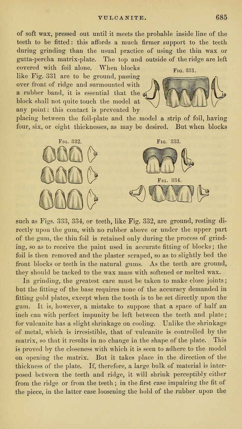 Fig. 331. of soft wax, pressed out until it meets the probable inside line of the teeth to be fitted: this afibrds a much firmer support to the teeth during grinding than the usual practice of using the thin wax or gutta-percha matrix-plate. The top and outside of the ridge are left covered with foil alone. AYhen blocks like Fig. 331 are to be ground, passing over front of ridge and surmounted with a rubber band, it is essential that the block shall not quite touch the model at any point: this contact is prevented by- placing between the foil-plate and the model a strip of foil, having four, six, or eight thicknesses, as may be desired. But when blocks Fig. 338. such as Figs. 333, 334, or teeth, like Fig. 332, are ground, resting di- rectly upon the gum, with no rubber above or under the upper part of the gum, the thin foil is retained only during the process of grind- ing, so as to receive the paint used in accurate fitting of blocks; the foil is then removed and the plaster scraped, so as to slightly bed the front blocks or teeth in the natural gums. As the teeth are ground, they should be tacked to the wax mass with softened or melted wax. In grinding, the greatest care must be taken to make close joints; but the fitting of the base requires none of the accuracy demanded in fitting gold plates, except when the tooth is to be set directly upon the gum. It is, however, a mistake to suppose that a space of half an inch can with perfect impunity be left between the teeth and plate; for vulcanite has a slight shrinkage on cooling. Unlike the shrinkage of metal, which is irresistible, that of vulcanite is controlled by the matrix, so that it results in no change in the shape of the plate. This is proved by the closeness with which it is seen to adhere to the model on opening the matrix. But it takes place in the direction of the thickness of the plate. If, therefore, a large bulk of material is inter- posed between the teeth and ridge, it will shrink perceptibly either from the ridge or from the teeth ; in the first case impairing the fit of the piece, in the latter case loosening the hold of the rubber upon the