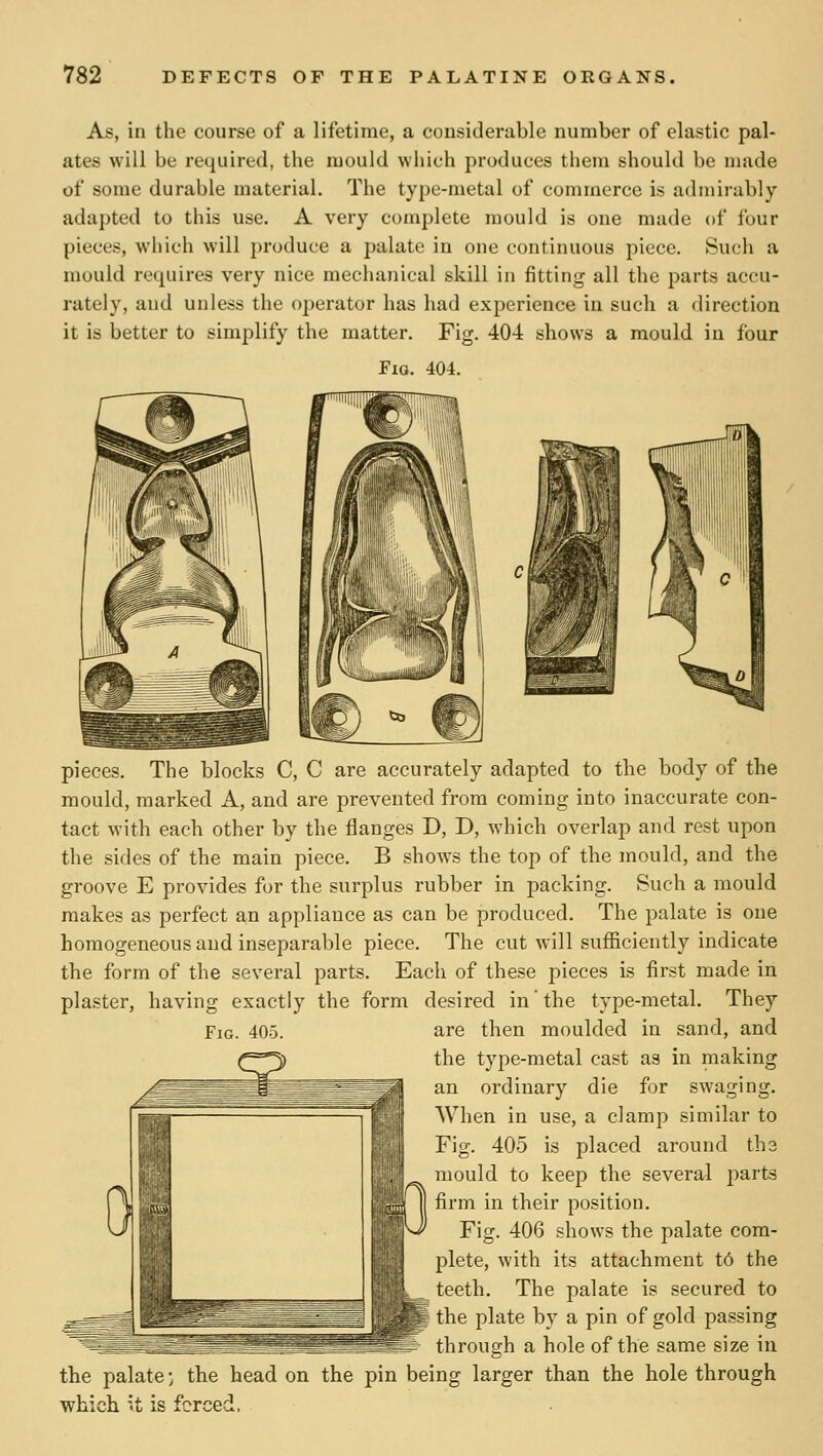 As, in the course of a lifetime, a considerable number of elastic pal- ates will be required, the mould which produces them should be made of some durable material. The type-metal of commerce is admirably adapted to this use. A very complete mould is one made of four pieces, which will })roduce a jjalate in one continuous piece. Such a mould requires very nice mechanical skill in fitting all the parts accu- rately, and unless the operator has had experience in such a direction it is better to simplify the matter. Fig. 40-i shows a mould in four JFio. 404. Fig. 405. pieces. The blocks C, C are accurately adapted to the body of the mould, marked A, and are prevented from coming into inaccurate con- tact with each other by the flanges D, D, which overlap and rest upon the sides of the main piece. B shows the top of the mould, and the groove E provides for the surplus rubber in packing. Such a mould makes as perfect an appliance as can be produced. The palate is one homogeneous and inseparable piece. The cut will sufficiently indicate the form of the several parts. Each of these pieces is first made in plaster, having exactly the form desired in' the type-metal. They are then moulded in sand, and the type-metal cast as in making an ordinary die for swaging. When in use, a clamp similar to Fig. 405 is placed around the mould to keep the several parts firm in their position. Fig. 406 shows the palate com- plete, with its attachment t6 the teeth. The palate is secured to the plate by a pin of gold passing 1^ through a hole of the same size in the palate •; the head on the pin being larger than the hole through which it is forced.