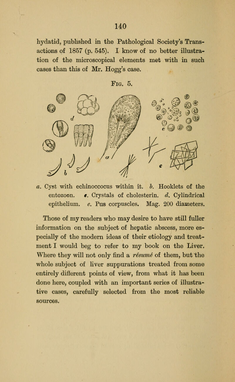 hydatid, published in the Pathological Society's Trans- actions of 1857 (p. 545). I know of no better illustra- tion of the microscopical elements met with in such cases than this of Mr. Hogg's case. Fig. 5. a. Cyst with echinoccocus within it. h. Hooklets of the entozoon. «. Crystals of cholesterin. d. Cylindrical epithelium, e. Pus corpuscles. Mag. 200 diameters. Those of my readers who may desire to have still fuller information on the subject of hepatic abscess, more es- pecially of the modern ideas of their etiology and treat- ment I would beg to refer to my book on the Liver. Where they will not only find a resume of them, but the whole subject of Uver suppurations treated from some entirely different points of view, from what it has been done here, coupled with an important series of illustra- tive cases, carefully selected from the most reliable sources.