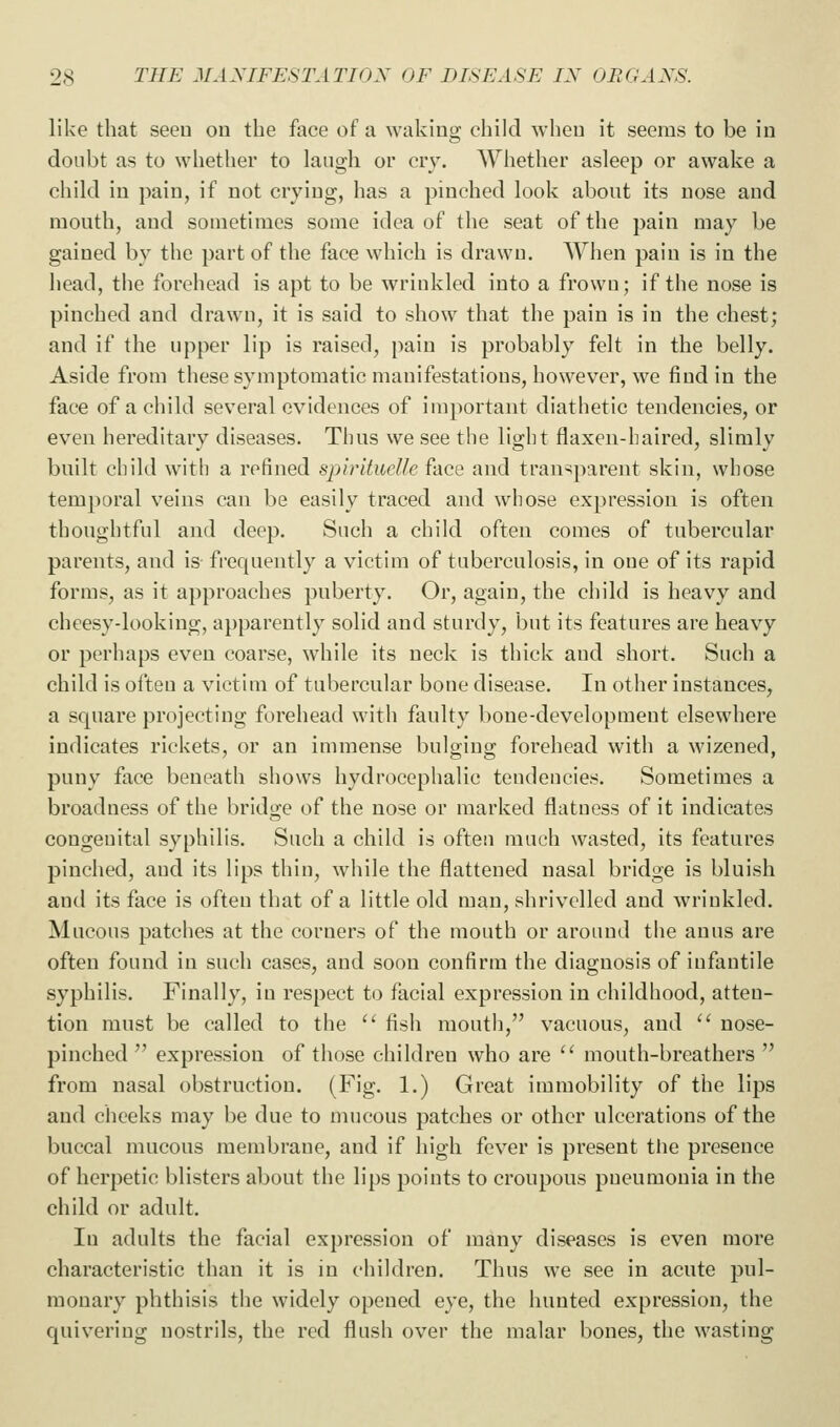 like that seen ou the face of a waking child when it seems to be in doubt as to whether to laugh or cry. Whether asleep or awake a child in pain, if not crying, has a pinched look about its nose and mouth, and sometimes some idea of the seat of the pain may be gained by the part of the face which is drawn. AVhen pain is in the head, the forehead is apt to be wrinkled into a frown; if the nose is pinched and drawn, it is said to show that the pain is in the chest; and if the upper lip is raised, pain is probably felt in the belly. Aside from these symptomatic manifestations, however, we find in the face of a child several evidences of important diathetic tendencies, or even hereditary diseases. Thus we see the light flaxen-haired, slimly built child with a refined spirltueUe face and transparent skin, whose temporal veins can be easily traced and whose expression is often thoughtful and deep. Such a child often comes of tubercular parents, and is frequently a victim of tuberculosis, in one of its rapid forms, as it approaches puberty. Or, again, the child is heavy and cheesy-looking, apparently solid and sturdy, but its features are heavy or perhaps even coarse, while its neck is thick and short. Such a child is often a victim of tubercular bone disease. In other instances, a square projecting forehead with faulty bone-development elsewhere indicates rickets, or an immense bulging forehead with a wizened, puny face beneath shows hydrocephalic tendencies. Sometimes a broadness of the bridge of the nose or marked flatness of it indicates congenital syphilis. Such a child is often much wasted, its features pinched, and its lips thin, while the flattened nasal bridge is bluish and its face is often that of a little old man, shrivelled and wrinkled. Mucous patches at the corners of the mouth or around the anus are often found in such cases, and soon confirm the diagnosis of infantile syphilis. Finally, in respect to facial expression in childhood, atten- tion must be called to the  fish mouth, vacuous, and  nose- pinched  expression of those children who are  mouth-breathers  from nasal obstruction. (Fig. 1.) Great immobility of the lips and cheeks may be due to mucous patches or other ulcerations of the buccal mucous membrane, and if high fever is present tlie presence of herpetic blisters about the lips points to croupous pneumonia in the child or adult. In adults the facial expression of many diseases is even more characteristic than it is in children. Thus we see in acute pul- monary phthisis the widely opened eye, the hunted expression, the quivering nostrils, the red flush over the malar bones, the wasting