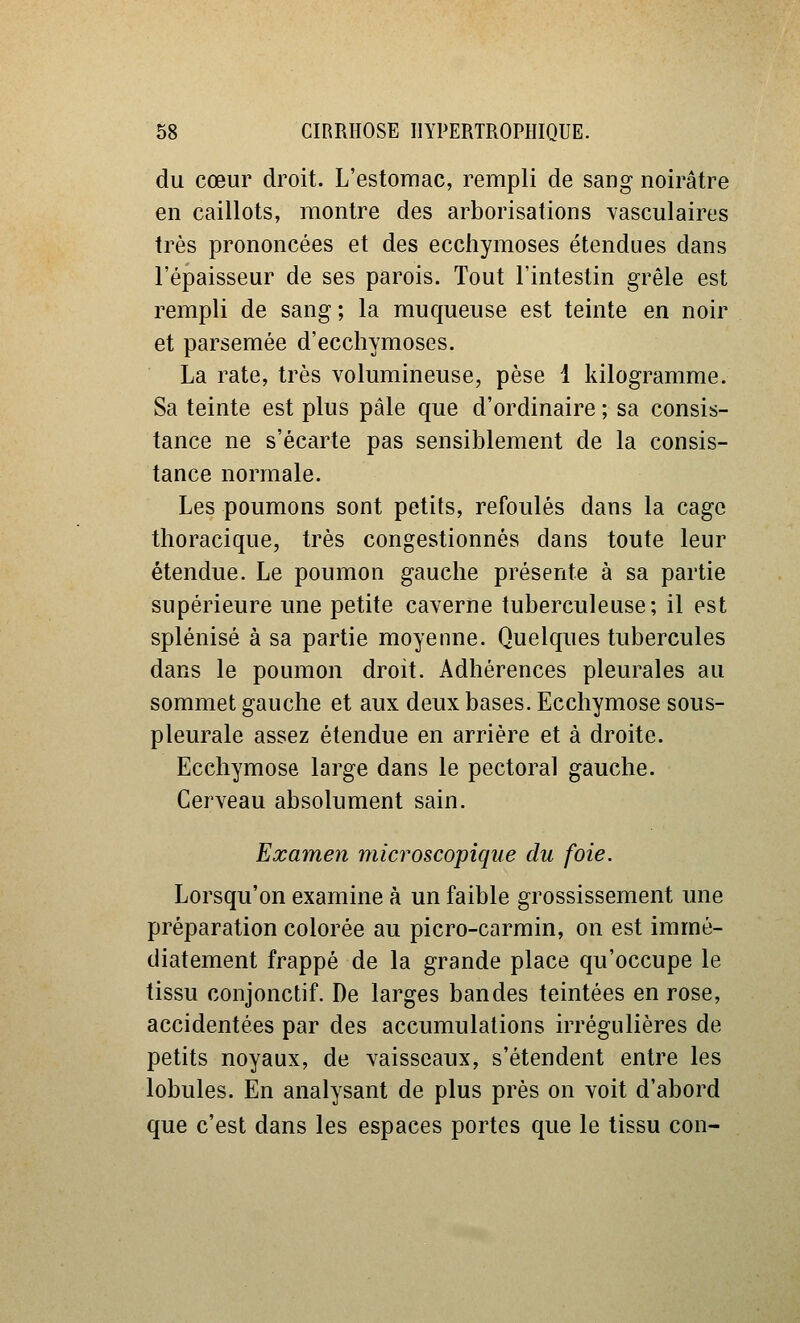 du cœur droit. L'estomac, rempli de sang noirâtre en caillots, montre des arborisations vasculaires très prononcées et des ecchymoses étendues dans l'épaisseur de ses parois. Tout l'intestin grêle est rempli de sang ; la muqueuse est teinte en noir et parsemée d'ecchymoses. La rate, très volumineuse, pèse 1 kilogramme. Sa teinte est plus pâle que d'ordinaire ; sa consis- tance ne s'écarte pas sensiblement de la consis- tance normale. Les poumons sont petits, refoulés dans la cage thoracique, très congestionnés dans toute leur étendue. Le poumon gauche présente à sa partie supérieure ime petite caverne tuberculeuse; il est splénisé à sa partie moyenne. Quelques tubercules dans le poumon droit. Adhérences pleurales au sommet gauche et aux deux bases. Ecchymose sous- pleurale assez étendue en arrière et à droite. Ecchymose large dans le pectoral gauche. Cerveau absolument sain. Examen microscopique du foie. Lorsqu'on examine à un faible grossissement une préparation colorée au picro-carrain, on est immé- diatement frappé de la grande place qu'occupe le tissu conjonctif. De larges bandes teintées en rose, accidentées par des accumulations irrégulières de petits noyaux, de vaisseaux, s'étendent entre les lobules. En analysant de plus près on voit d'abord que c'est dans les espaces portes que le tissu con-