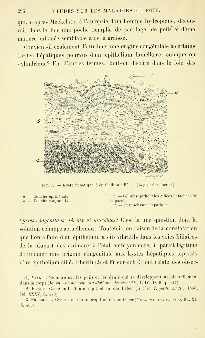 qui. d'après Meckel (1), à l'autopsie d'un homme hydropique, décou- vrit dans le foie une poche remplie de cartilage, de poils et d'une matière pullacée semblable à de la graisse. Convient-il également d'attribuer une origine congénitale à certains kystes hépatiques pourvus d'un épithélium lamellaire, cubique ou cyhndrique? En d'autres termes, doit-on décrire dans le foie des A HARMAhJiHJ Fig. 36. — Kyste hépatiqae à épithélium cilié. — (45 grossissements.) a. — Couche épithéliale. b. — Couche conjonctive. c. —Cellules épithéliales ciliées détachées de la paroi. d. — Parenchyme hépatique. kystes congénitaux séreux et mucoicks? C'est là une question dont la solution échappe actuellement. Toutefois, en raison de la constatation que l'on a faite d'un épithélium à cils vibratils dans les voies bihaires de la plupart des animaux à l'état embryonnaire, il paraît légitime d'attribuer une origine congénitale aux kystes hépatiques tapissés d'un épithélium cilié. Eberth (2) et Friedreich (3) ont relaté des obser- (1) Meckel, Mémoire sar les poils et les dents qui se développent accidentellemenl dans le corps {Journ. complément, du diclionn. des se. méd., t. IV, 1819, p. 127). (2) Eberth, Cyste mit Flinimerepithel in der Leber {Archiv. f. path. Anat., 1866, Bd. XXXV, S. 478). (3) Friedreich, Cyste mit Flimmerepithel in der Leber [Virchows Archiv, 18o6, Bd. XI, S. 466).
