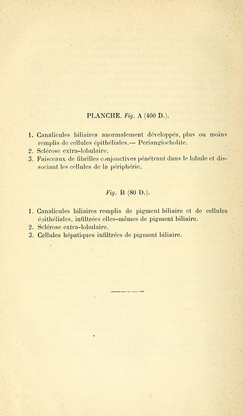 PLANCHE. Fig. A (400 D.). 1. Ganalicules biliaires anormalement développés, plus ou moins remplis de cellules épithéliales.— Periangiocholite. 2. Sclérose extra-lobulaire. 3. Faisceaux de fibrilles conjonctives pénétrant dans le lobule et dis- sociant les cellules de la périphérie. Fig. B (80 D.). 1. Ganalicules biliaires remplis de pigment biliaire et de cellules épithéliales, infiltrées elles-mêmes de pigment biliaire. 2. Sclérose extra-lobulaire. 3. Cellules hépatiques infiltrées de pigment biliaire.