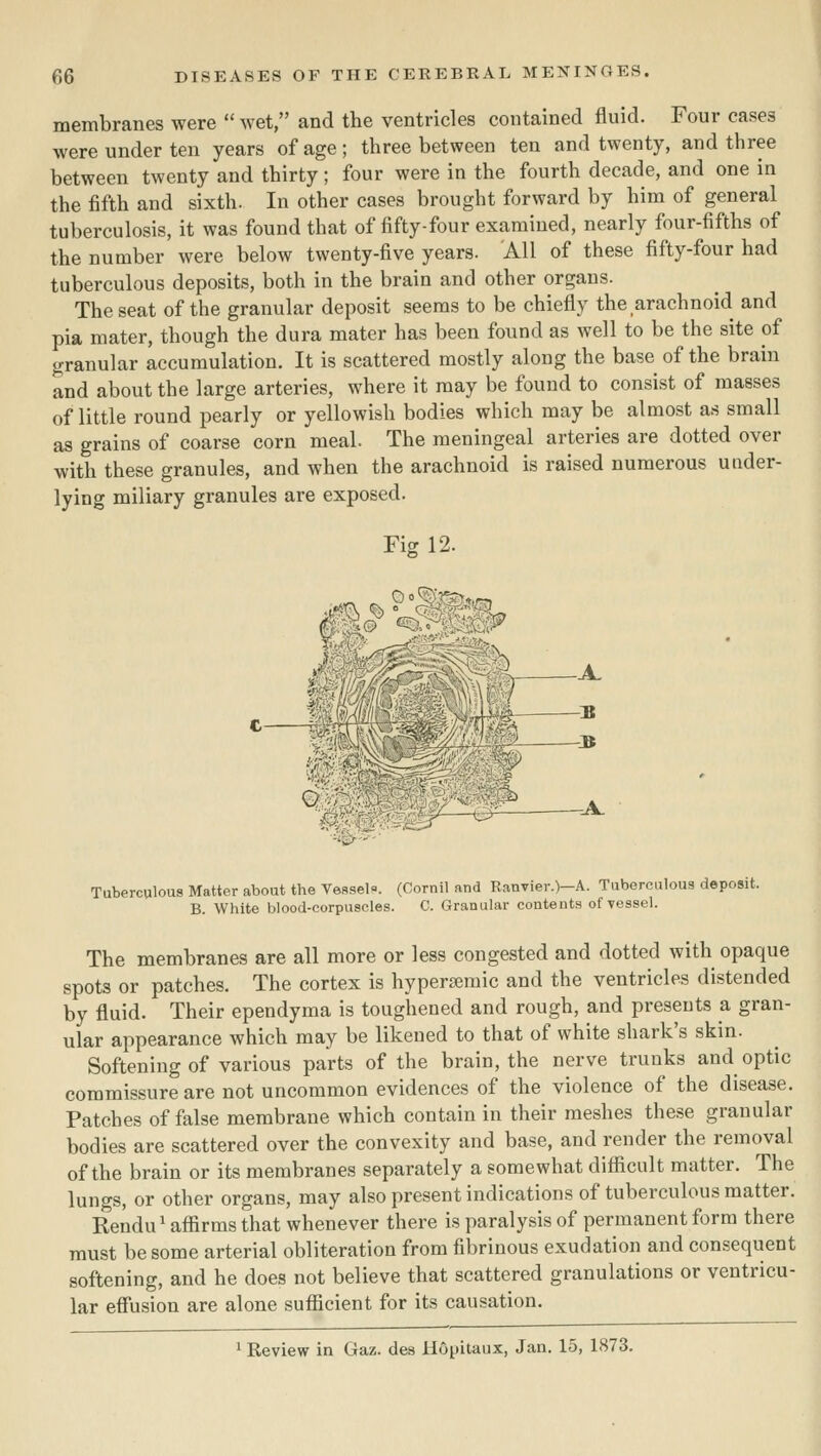 membranes were  wet, and the ventricles contained fluid. Four cases were under ten years of age; three between ten and twenty, and three between twenty and thirty; four were in the fourth decade, and one in the fifth and sixth. In other cases brought forward by him of general tuberculosis, it was found that of fifty-four examined, nearly four-fifths of the number were below twenty-five years. AH of these fifty-four had tuberculous deposits, both in the brain and other organs. The seat of the granular deposit seems to be chiefly the arachnoid and pia mater, though the dura mater has been found as well to be the site of granular accumulation. It is scattered mostly along the base of the brain and about the large arteries, where it may be found to consist of masses of little round pearly or yellowish bodies which may be almost as small as grains of coarse corn meal. The meningeal arteries are dotted over with these granules, and when the arachnoid is raised numerous under- lying miliary granules are exposed. Fm 12. Tuberculous Matter about the Vessel-. (Cornil and Ranvier.)-A. Tuberculous deposit. B. White blood-corpascles. C. Granular contents of vessel. The membranes are all more or less congested and dotted with opaque spots or patches. The cortex is hyperseraic and the ventricles distended by fluid. Their ependyma is toughened and rough, and presents a gran- ular appearance which may be likened to that of white shark's skin. Softening of various parts of the brain, the nerve trunks and optic commissure are not uncommon evidences of the violence of the disease. Patches of false membrane which contain in their meshes these granular bodies are scattered over the convexity and base, and render the removal of the brain or its membranes separately a somewhat difficult matter. The lungs, or other organs, may also present indications of tuberculous matter. Rendu' affirms that whenever there is paralysis of permanent form there must be some arterial obliteration from fibrinous exudation and consequent softening, and he does not believe that scattered granulations or ventricu- lar effusion are alone sufficient for its causation. 1 Review in Gaz. des Hopitaux, Jan. 15, 1873.