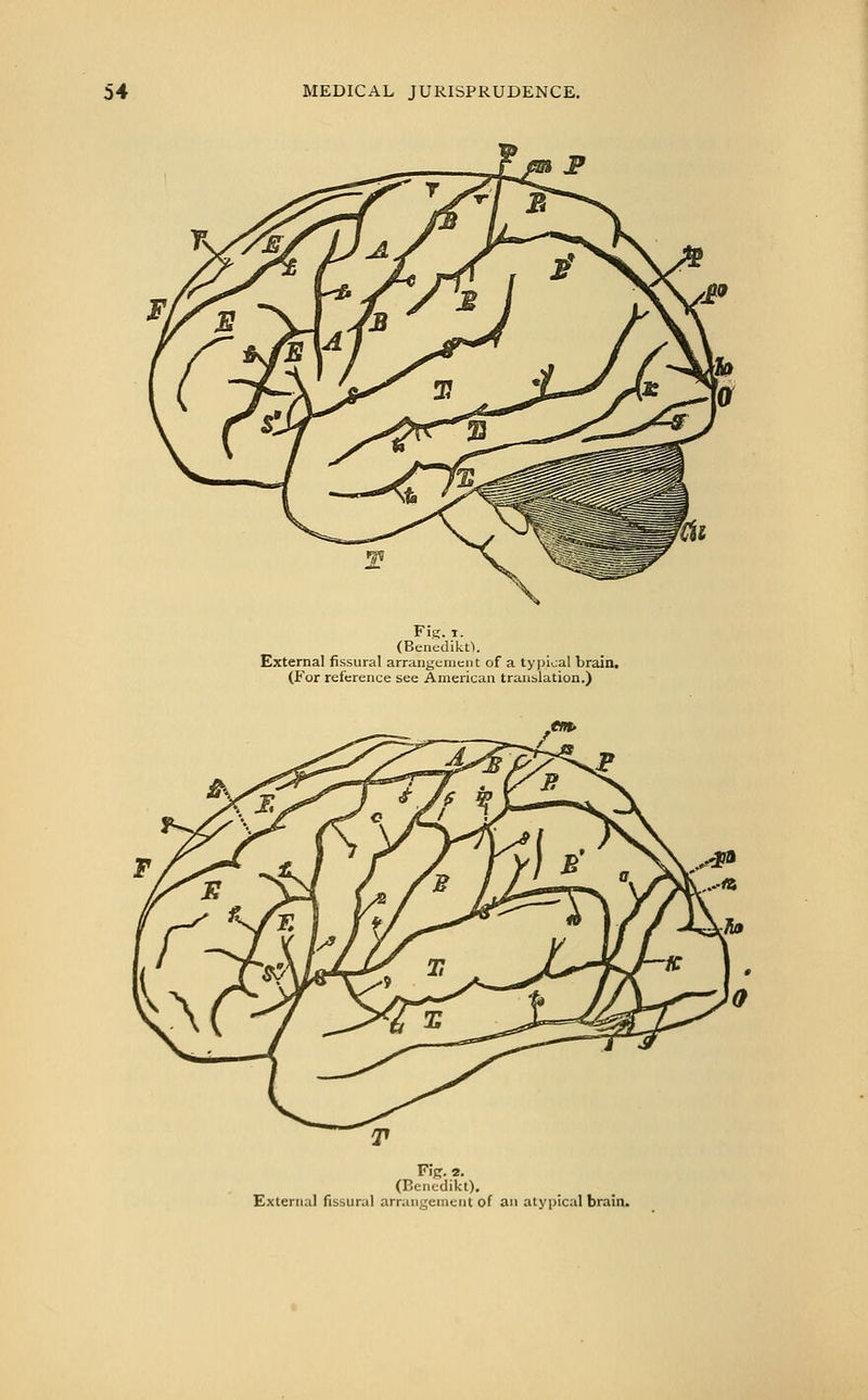 Fi?. I. (Benedikt>. External fissural arrangement of a typical brain. (For reference see American traiiblation.) ^tfH^ Fir. 2. (Benedikt), External fissural arrangement of an atypical brain.