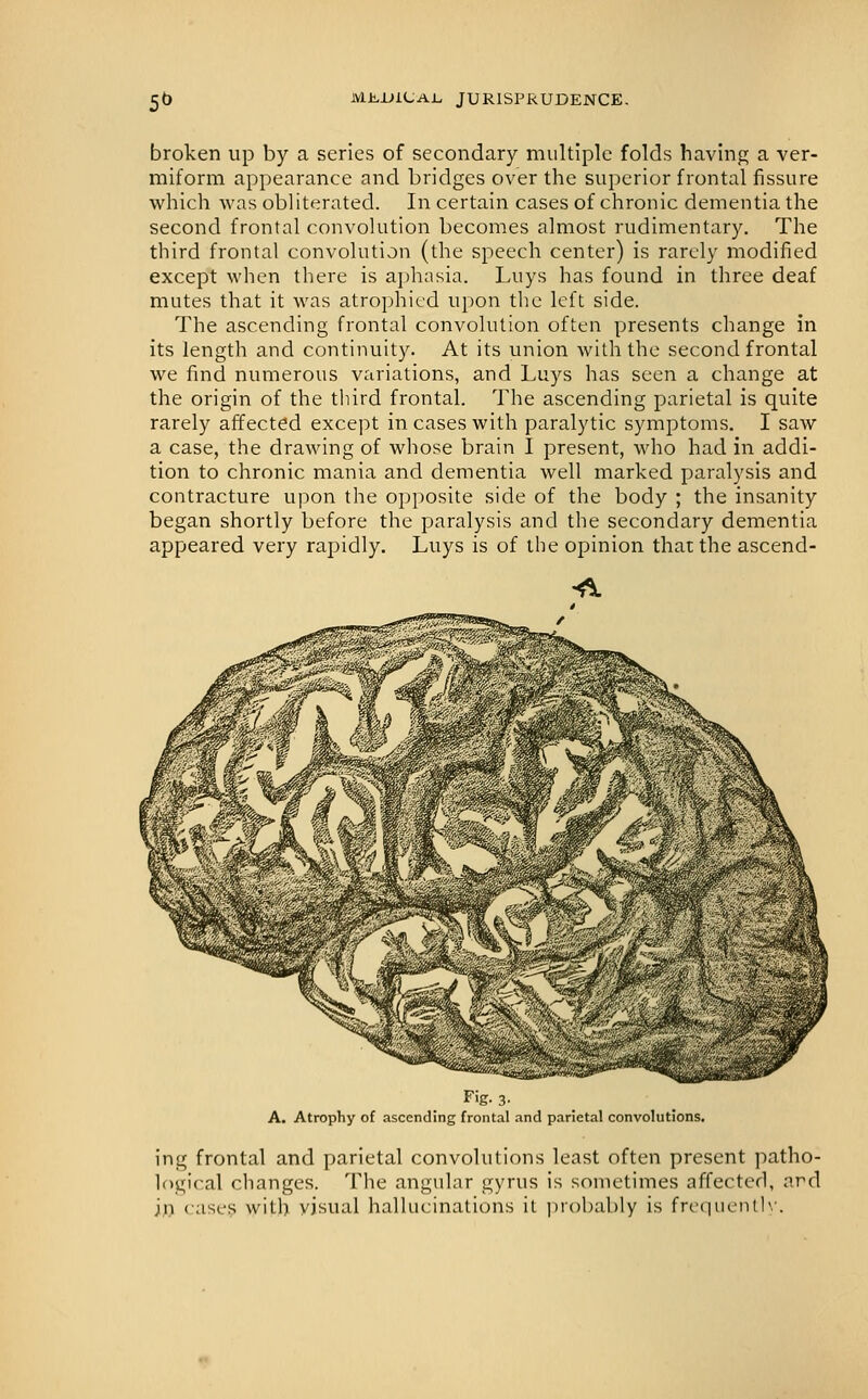 broken up by a series of secondary multiple folds having a ver- miform appearance and bridges over the superior frontal fissure which was obliterated. In certain cases of chronic dementia the second frontal convolution becomes almost rudimentary. The third frontal convolution (the speech center) is rarely modified except when there is ai)hasia. Luys has found in three deaf mutes that it was atrophied upon the left side. The ascending frontal convolution often presents change in its length and continuity. At its union with the second frontal we find numerous variations, and Luys has seen a change at the origin of the third frontal. The ascending parietal is quite rarely affected except in cases with paralytic symptoms. I saw a case, the drawing of whose brain I present, who had in addi- tion to chronic mania and dementia well marked paralysis and contracture upon the opposite side of the body ; the insanity began shortly before the paralysis and the secondary dementia appeared very rapidly. Luys is of the opinion that the ascend- Fig. 3. A. Atrophy of ascending frontal and parietal convolutions. ing frontal and parietal convolutions least often present patho- logical changes. The angular gyrus is sometimes affecterl, ard in cases with visual halhicinatiuns it probably is fn'qncntlv.