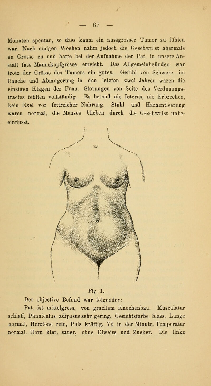 Monaten spontan, so dass kaum ein nussgrosser Tumor zu fühlen war. Nach einigen Wochen nahm jedoch die Geschwulst abermals an Grösse zu und hatte bei der Aufnahme der Pat. in unsere An- stalt fast Mannskopfgrösse erreicht. Das Allgemeinbefinden war trotz der Grösse des Tumors ein gutes. Gefühl von Schwere im Bauche und Abmagerung in den letzten zwei Jahren waren die einzigen Klagen der Frau. Störungen von Seite des Verdauungs- tractes fehlten vollständig. Es betand nie Icterus, nie Erbrechen, kein Ekel vor fettreicher Nahrung. Stuhl und Harnentleerung waren normal, die Menses blieben durch die Geschwulst unbe- einflusst. Fig. 1. Der objeetive Befund war folgender: Pat. ist mittelgross, von gracilem Knochenbau. Musculatur schlaff, Pannieulus adiposus sehr gering, Gesichtsfarbe blass. Lunge normal, Herztöne rein. Puls kräftig, 72 in der Minute. Temperatur normal. Harn klar, sauer, ohne Eiweiss und Zucker. Die linke