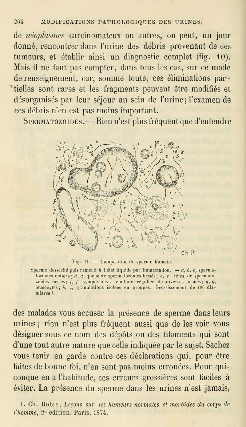 de néoplasmes carcinomateux ou autres, on peut, un jour donné, rencontrer dans l'urine des débris provenant de ces tumeurs, et établir ainsi un diagnostic complet (fig. 10). Mais il ne faut pas compter, dans tous les cas, sur ce mode de renseignement^ car, somme toute, ces éliminations par- tielles sont rares et les fragments peuvent être modifiés et désorganisés par leur séjour au sein de l'urine; l'examen de ces débris n'en est pas moins important. Spermatozoïdes.—Rien n'est plus fréquent que d'entendre cK.R Fig. 11. — Composition du sperme humain. Sperme desséciié puis ramené à l'état liquide par humectation. — a, b, e, sperma- tozoïdes entiers ; d, rf, queue de spermatozoïdes brisés; e, e, têtes de spermato- zoïdes brisés; f, f, sympexions à contour régulier de diverses formes; y, g, leucocytes; h, i, granulations isolées en groupes. Grossissement de 400 dia- mètres '. des malades vous accuser la présence de sperme dans leurs urines ; rien n'est plus fréquent aussi que de les voir vous désigner sous ce nom des dépôts ou des filaments qui sont d'une tout autre nature que celle indiquée par le sujet. Sachez vous tenir en garde contre ces déclarations qui, pour être faites de bonne foi, n'en sont pas moins erronées. Pour qui- conque en a l'habitude, ces erreurs grossières sont faciles à éviter. La présence du sperme dans les urines n'est jamais, 1. Ch. Robiu, Leçons sur les humeurs normales et morbides du corps de l'homme, 2^ édition. Paris, 1874.