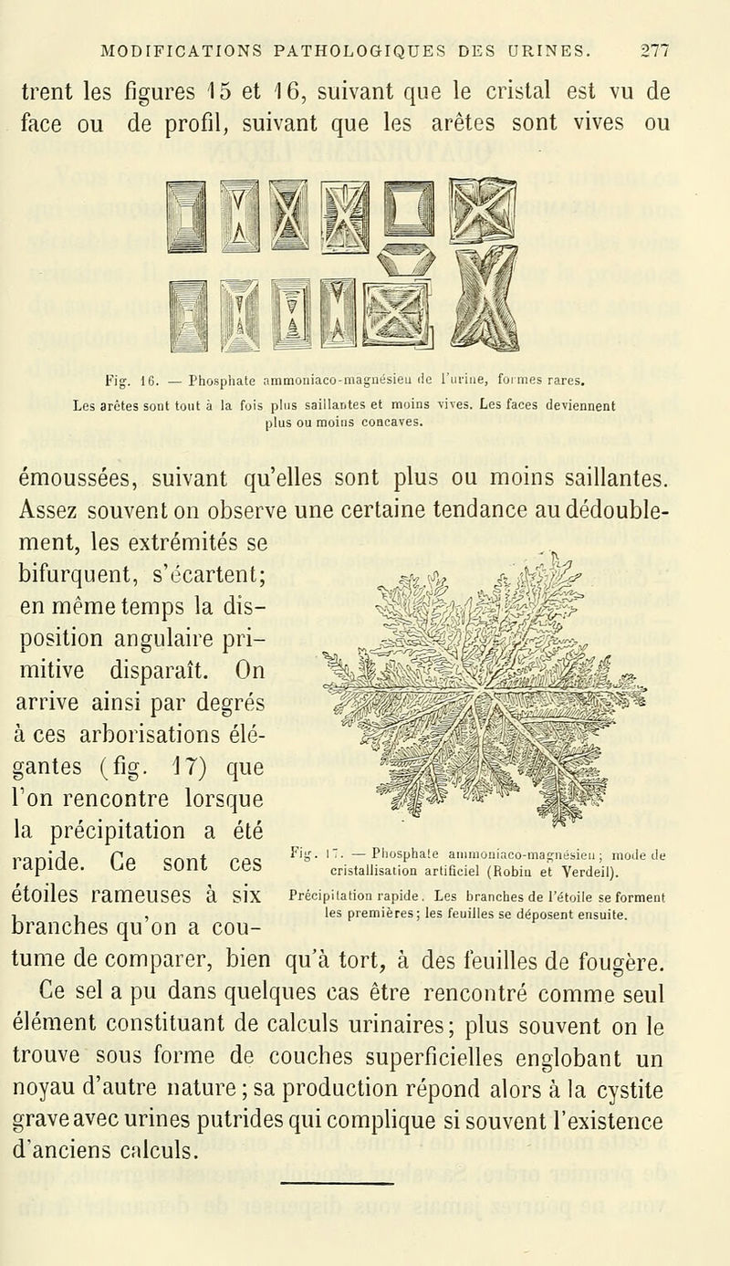 trent les figures 15 et 16, suivant que le cristal est vu de face ou de profil, suivant que les arêtes sont vives ou ■^i Fig. 16. — Phosphate ammoniaco-maguésieu de rui-ine, fojmes rares. Les arêtes sont tout à la fois phis saillautes et moins -vives. Les faces deviennent plus ou moins concaves. émoussées, suivant qu'elles sont plus ou moins saillantes. Assez souvent on observe une certaine tendance au dédouble- ment, les extrémités se bifurquent, s'écartent; en même temps la dis- position angulaire pri- mitive disparaît. On arrive ainsi par degrés à ces arborisations élé- gantes (fig. 17) que Ton rencontre lorsque la précipitation a été rapide. Ce sont ces étoiles rameuses à six branches qu'on a cou- tume de comparer, bien qu'à tort, à des feuilles de fougère. Ce sel a pu dans quelques cas être rencontré comme seul élément constituant de calculs urinaires; plus souvent on le trouve sous forme de couches superficielles englobant un noyau d'autre nature ; sa production répond alors à la cystite grave avec urines putrides qui comphque si souvent l'existence d'anciens calculs. '•'■^ffi-^ ^al Fig. 17. —Pliosphaie aiiimouiaco-magiiébieu ; motie de cristallisation artificiel (Robin et Verdeil). Précipilation rapide. Les branches de l'étoile se forment les premières; les feuilles se déposent ensuite.