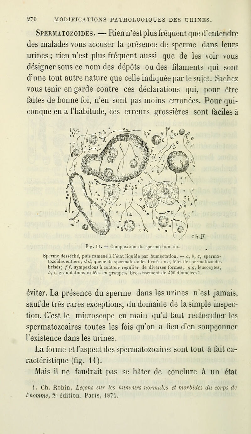 Speraiatozoides. — Rien n'est plus fréquent que d'entendre des malades vous accuser la présence de sperme dans leurs urines ; rien n'est plus fréquent aussi que de les voir vous désigner sous ce nom des dépôts ou des filaments qui sont d'une tout autre nature que celle indiquée par le sujet. Sachez vous tenir en garde contre ces déclarations qui, pour être faites de bonne foi, n'en sont pas moins erronées. Pour qui- conque en a l'habitude, ces erreurs grossières sont faciles à ^m^ 'ë^;V '^fe V y ch.R Fig. II. — Compositioii du sperme hiunain. Sperme desséché, puis ramené à l'éfat liquide par humectation. — a, h, c, sperma- tozoïdes entiers : 4. d, queue de sparmatozoîdes brisés : e e, tètes de spermatozoïdes brisés; f f, sympesicms à contour régulier de dÏTerses formes; ^ ^, leucocvtes; h, i, granulations isolées en groupes. Grossissement de 400 diamètres 1. éviter. La présence du sperme dans les urines n'est jamais, sauf de très rares exceptions, du domaine de la simple inspec- tion. C'est le microscope en main qu'il faut rechercher les spermatozoaires toutes les fois qu'on a lieu d'en soupçonner Texistence dans les urines. La forme et l'aspect des spermatozoaire= sont tout à l'ait ca- ractéristique (fig. 11). Mais il ne faudrait pas se hâter de conclure à un état 1. Ch. Rnbin. Leçons sur les humrurs normales et morbides du corps de l'honune, 'l^ tdition. Paris. 1874.