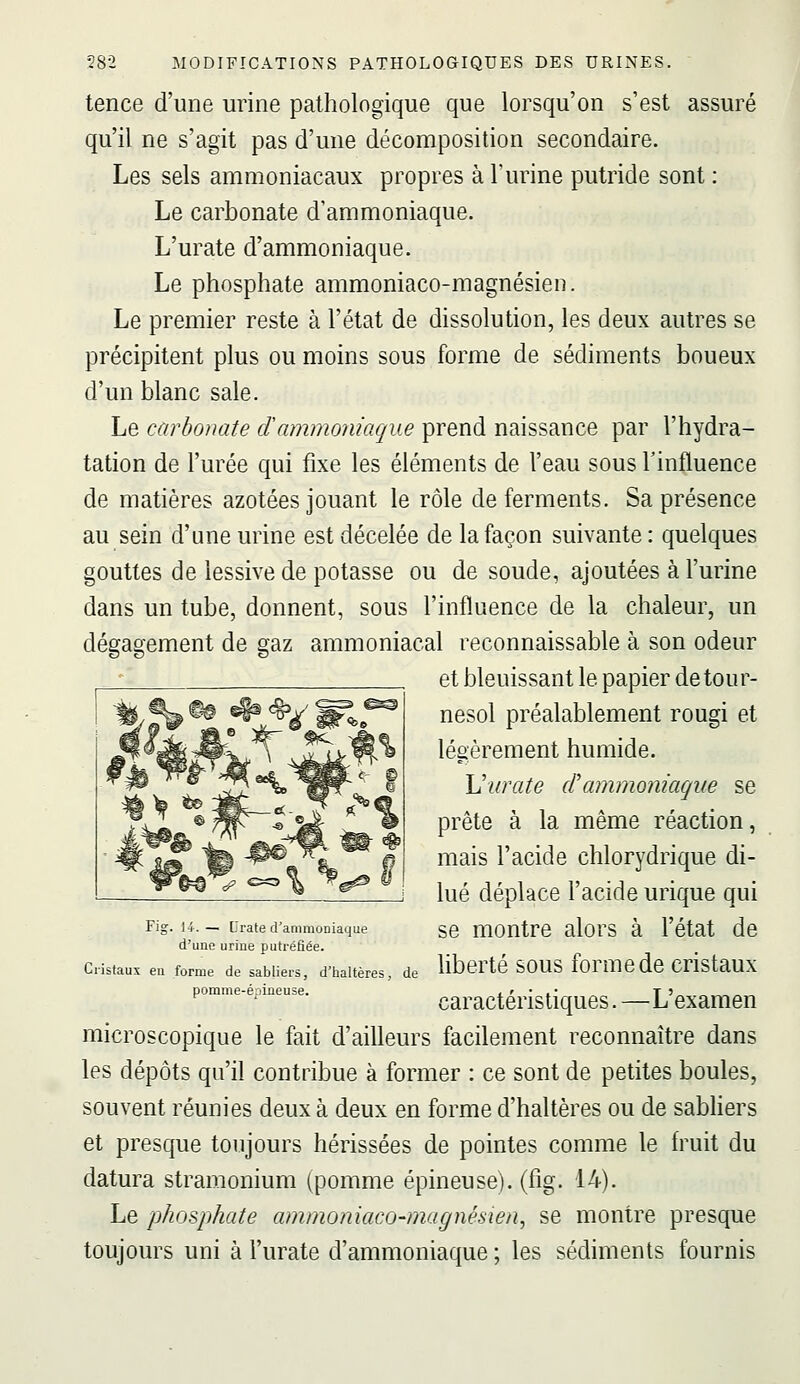 tence d'une urine pathologique que lorsqu'on s'est assuré qu'il ne s'agit pas d'une décomposition secondaire. Les sels ammoniacaux propres à l'urine putride sont : Le carbonate d'ammoniaque. L'urate d'ammoniaque. Le phosphate ammoniaco-magnésien. Le premier reste à l'état de dissolution, les deux autres se précipitent plus ou moins sous forme de sédiments boueux d'un blanc sale. Le carbonate dammoniaque prend naissance par l'hydra- tation de l'urée qui fixe les éléments de l'eau sous Tinfluence de matières azotées jouant le rôle de ferments. Sa présence au sein d'une urine est décelée de la façon suivante : quelques gouttes de lessive de potasse ou de soude, ajoutées à l'urine dans un tube, donnent, sous l'influence de la chaleur, un dégagement de gaz ammoniacal reconnaissable à son odeur et bleuissant le papier de tour- nesol préalablement rougi et légèrement humide. Viirate ctammoniaque se prête à la même réaction, mais l'acide chlorydrique di- lué déplace l'acide urique qui se montre alors à l'état de liberté sous forme de cristaux caractéristiques. —L'examen microscopique le fait d'ailleurs facilement reconnaître dans les dépôts qu'il contribue à former : ce sont de petites boules, souvent réunies deux à deux en forme d'haltères ou de sabliers et presque toujours hérissées de pointes comme le fruit du datura stramonium (pomme épineuse), (fig. 14). Le phosphate ammoniaco-magnésien, se montre presque toujours uni à l'urate d'ammoniaque ; les sédiments fournis Fig. 14.— L'rate d'ammoniaque d'une urine putréfiée. Cristaux en forme de sabliers, d'iialtères, pomme-épineuse. de