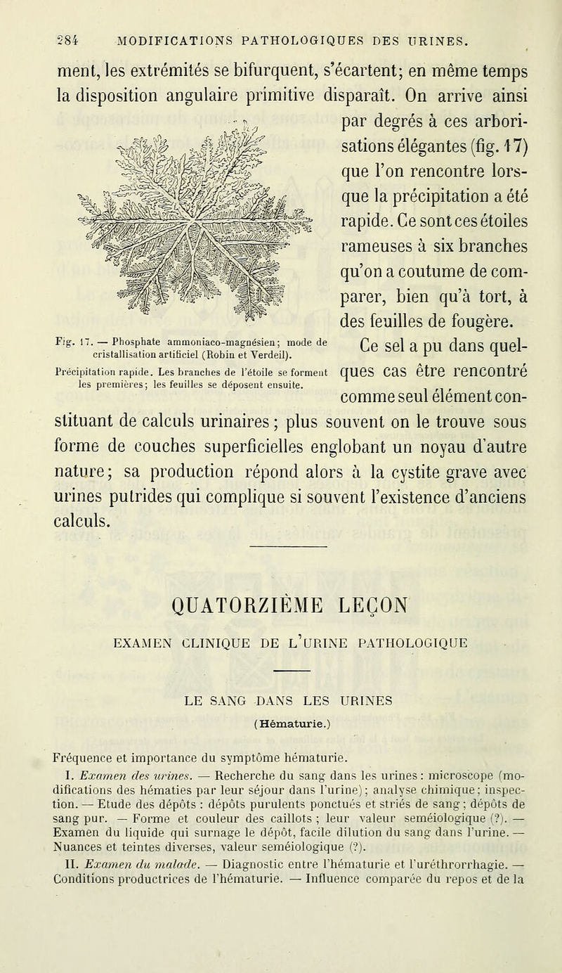 ment, les extrémités se bifurquent, s'écartent; en même temps la disposition angulaire primitive disparaît. On arrive ainsi par degrés à ces arbori- sations élégantes (fig. 47) que l'on rencontre lors- que la précipitation a été rapide. Ce sont ces étoiles rameuses à six branches qu'on a coutume de com- parer, bien qu'à tort, à des feuilles de fougère. Fig. 17. - Phosphate ammoniaco-magnésien ; mode de Qg gg| ^ p^ (J^nS QUel- cristallisation artiheiel (Robin et Verdeil). '^ T- Précipitation rapide. Les branches de l'étoile se forment qUCS CaS ÔtrC reUCOUtré les premières; les feuilles se déposent ensuite. comme seul élément con- stituant de calculs urinaires ; plus souvent on le trouve sous forme de couches superficielles englobant un noyau d'autre nature; sa production répond alors à la cystite grave avec urines putrides qui complique si souvent l'existence d'anciens calculs. QUATORZIÈME LEÇON EXAMEN CLINIQUE DE L URINE PATHOLOGIQUE LE SANG DANS LES URINES (Hématurie.) Fréquence et importance du symptôme hématurie. I. Examen des urines. — Recherche du sang dans les urines: microscope (mo- difications des hématies par leur séjour dans l'urine); analyse chimique: inspec- tion. — Etude des dépôts : dépôts purulents ponctués et striés de sang ; dépôts de sang pur. — Forme et couleur des caillots ; leur valeur seméiologique (?). — Examen du liquide qui surnage le dépôt, facile dilution du sang dans l'urine. — Nuances et teintes diverses, valeur seméiologique (?). II. Examen du malade. — Diagnostic entre l'hématurie et l'uréthrorrhagie. — Conditions productrices de l'hématurie. — Influence comparée du repos et de la