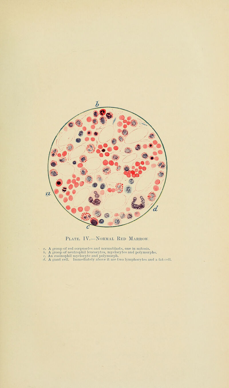 Plate. IV.—Normal Red Marrow. a. A group of red eorpiisclps aiirt normoblasts, one in mitosis. /;. A group of neutrophil leucocytes, myelocytes and polymorphs. <\ An eosinoijhil myelocyte and loolymorph. (1. A giant cell. Immediately above it are two lymphocytes and a fat-cell.