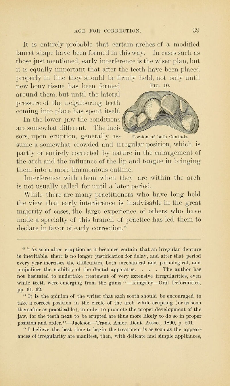 It is entirely jDrobable tliat certain arches of a modified lancet shape have been formed in this way. In cases such as those just mentioned, early interference is the wiser plan, but it is equally important that after the teeth have been placed properly in line they should be firmly held, not only until new bony tissue has been formed Fig. lo. around them, but until the lateral pressure of the neighboring teeth coming into place has spent itself In the lower jaw the conditions are somewhat dififerent. The inci- sors, upon eruption, generally as- Torsion of both CentralsT sume a somewhat crowded and irregular position, which is partly or entirely corrected by nature in the enlargement of the arch and the influence of the lip and tongue in bringing them into a more harmonious outline. Interference with them when they are within the arch is not usually called for until a later period. While there are many practitioners who have long held the view that early interference is inadvisable in the great majority of cases, the large experience of others who have made a specialty of this branch of practice has led them to declare in favor of early correction.* * ''As soon after eruption as it becomes certain that an irregular denture is inevitable, there is no longer justification for delay, and after that period every year increases the difficulties, both mechanical and pathological, and prejudices the stability of the dental apparatus. . . . The author has not hesitated to undertake treatment of very extensive irregularities, even vs^hile teeth were emerging from the gums.—Kingsley—Oral Deformities, pp. 61, 62. It is the opinion of the writer that each tooth should be encouraged to take a correct position in the circle of the arch while erupting (or as soon thereafter as practicable), in order to promote the proper development of the jaw, for the teeth next to be erupted are thus more likely to do so in proper position and order.—Jackson—Trans. Amer. Dent. Assoc, 1890, p. 201. I believe the best time to begin the treatment is as soon as the appear- ances of irregularity are manifest, then, with delicate and simple appliances,