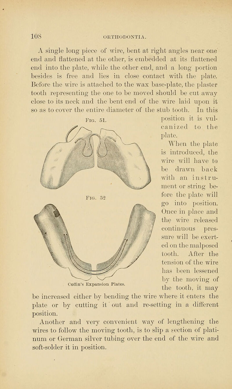 A single long piece of wire, bent at right angles near one' end and flattened at the other, is embedded at its flattened end into the plate, while the other end, and a long portion besides is free and lies in close contact with the plate- Before the wire is attached to the wax base-plate, the plaster tooth representing the one to be moved should be cut away- close to its neck and the bent end of the wire laid upon it so as to cover the entire diameter of the stub tooth. In this Fig. 51. position it is vul- canized to the plate. When the plate is introduced, the wire will have to be drawn back with an i n s t r u- ment or string be- fore the plate will go into position. Once in place and the wire released continuous pres- sure will be exert- ed on the malposed tooth. After the tension of the wire has been lessened by the moving of the tooth, it may- be increased either by bending the wire where it enters the plate or by cutting it' out and re-setting in a different position. Another and very convenient way of lengthening the wires to follow the moving tooth, is to slip a eection of plati- num or German silver tubing over the end of the wire and soft-solder it in position. Fig. 52 Coffin's Expansion Plates.