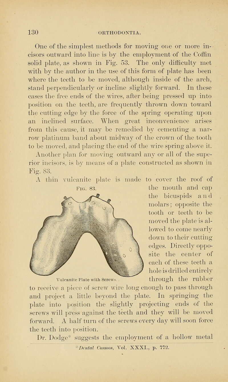 One of the simplest methods for movmg one or more in-' cisors outM^arcl into hne is b}^ the employment of the Coffin solid plate, as shown in Fig. 53. The only difficulty met with by the author in the use of this form of plate has been where the teeth to be moved, although inside of the arch, stand perj^endicularly or incline slightly forward. In these cases the free ends of the wires, after being pressed up into position on the teeth, are frequently thrown down toward the cutting edge by the force of the spring operating upon an inclined surface. When great inconvenience arises from this cause, it may be remedied b}^ cementing a nar- row platinum band about midway of the crown of the tooth to be moved, and placing the end of the wire spring above it. Another plan for moving outward any or all of the supe- rior incisors, is by means of a plate constructed as shown in Fig. 83. A thin vulcanite plate is made to cover the roof of Fig. 83. the mouth and cap the bicuspids a n d molars; opposite the tooth or teeth to be moved the plate is al- lowed to come nearly down to their cutting edges. Directly oppo- site the center of each of these teeth a hole is drilled entirely Vulcanite Plate with Screw*. tlirOUgh the rubber to receive a piece of screw wire long enough to pass through and project a httle beyond the plate. In springing the plate into position the slightly projecting ends of the screws will press against the teeth and they will be moved forward. A half turn of the screws every day will soon force the teeth into position. Dr. Dodge* suggests the employment of a hollow metal