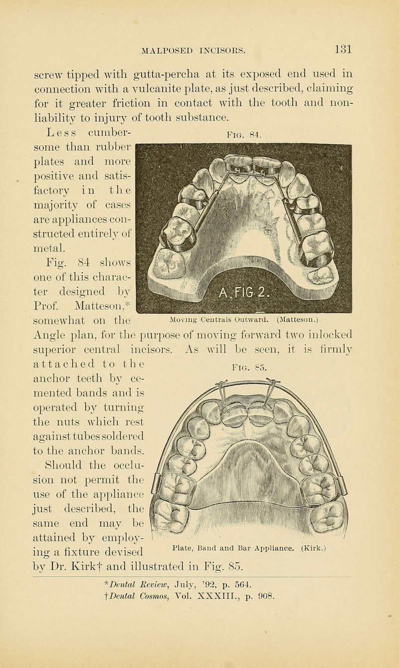 screw tipped with gutta-percha at its exposed end used in connection with a vulcanite plate, as just described, claiming for it greater friction in contact with the tooth and non- liability to injury of tooth substance. Less cumber- fig. 84. some than rubber plates and more positive and satis- factory in the majority of cases are appliances con- structed entirely of metal. Fig. 84 shows one of this charac- ter designed by Prof. Matteson,* somewhat on the Moving Ceutrals Outward. (Matteson.) Angle plan, for the purpose of moving forward two inlocked superior central incisors. As will be seen, it is firml}^ attached to the anchor teeth by ce- mented bands and is operated by turning the nuts which rest against tubes soldered to the anchor bands. Should the occlu- sion not permit the use of the appliance just described, the same end may be attained by employ- ing a fixture devised by Dr. Kirkf and illustrated in Fig. 85. * Dental Review, July, '92, p. 564. ■\Dental Cosmos, Vol. XXXIII., p. 908. Fig. 85. Plate, Band and Bar Appliance. (Kirk.)