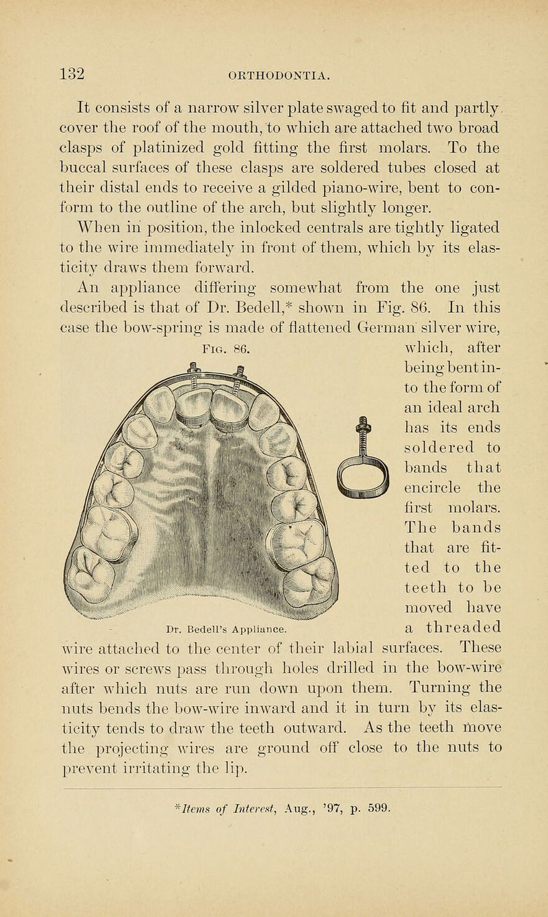 It consists of a narrow silver plate swaged to fit and partly, cover the roof of the mouth, to which are attached two broad clasps of platinized gold fitting the first molars. To the buccal surfaces of these clasps are soldered tubes closed at their distal ends to receive a gilded piano-wire, bent to con- form to the outline of the arch, but slightly longer. When in position, the inlocked centrals are tightly ligated to the wire immediately in front of them, which by its elas- ticity draws them forward. An appliance differing somewhat from the one just described is that of Dr. Bedell,* shown in Fig. 86. In this case the bow-spring is made of flattened German silver wire, Fig. 86. which, after being bent in- to the form of an ideal arch has its ends soldered to bands that encircle the first molars. The bands that are fit- ted to the teeth to be moved have dt Bedell's. Appliance a threaded wire attached to the center of their labial surfaces. These wires or screws pass through holes drilled in the bow-wire after which nuts are run down upon them. Turning the nuts bends the bow-wire inward and it in turn by its elas- ticity tends to dra^v the teeth outward. As the teeth move the projecting wires are ground off close to the nuts to prevent irritating the lip. ^liems of Infercf^t, Aug., '97, p. 599.