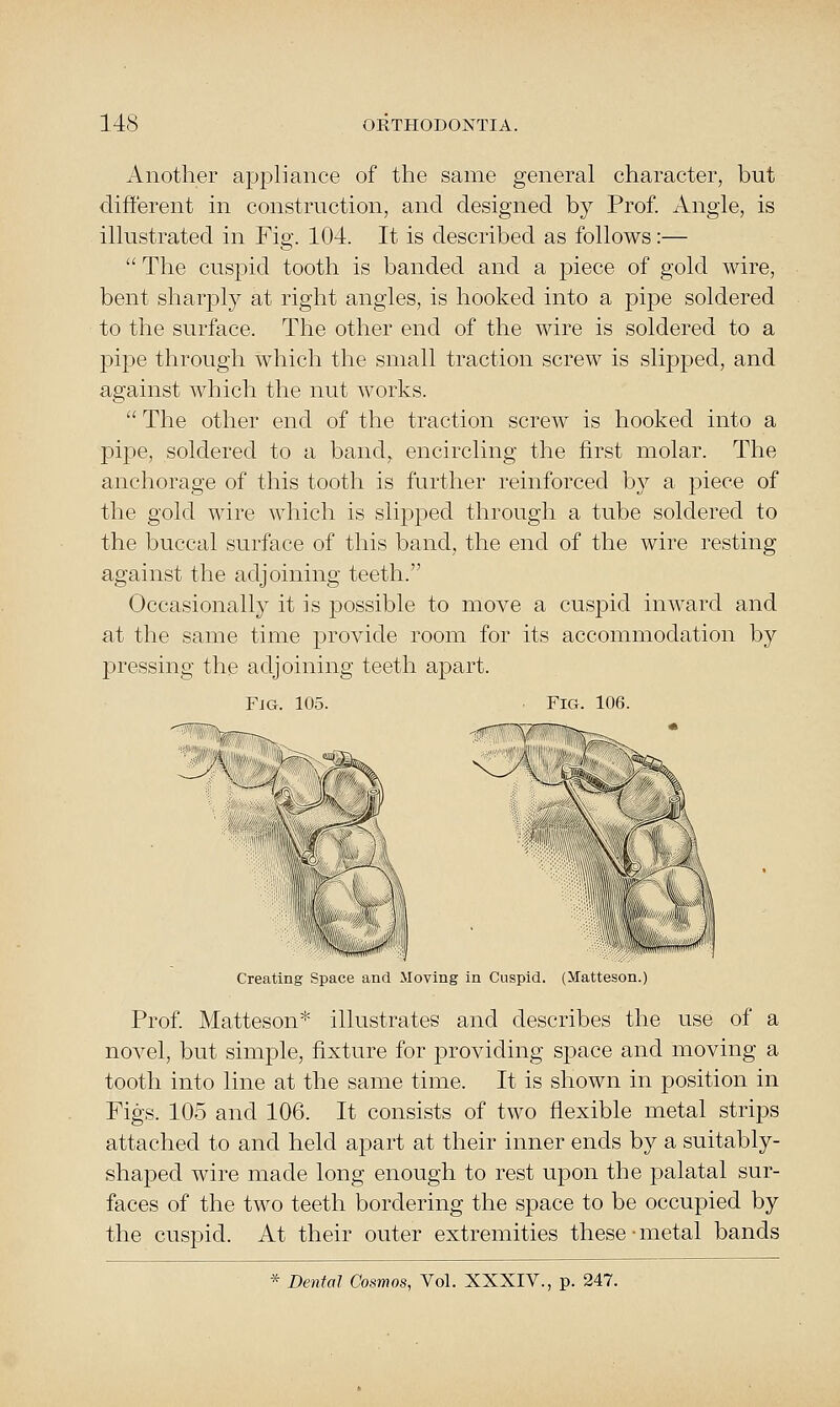 Aiiotlier appliance of the same general character, but different in construction, and designed by Prof. Angle, is illustrated in Fig. 104. It is described as follows:—  The cuspid tooth is banded and a piece of gold wire, bent sharply at right angles, is hooked into a pipe soldered to the surface. The other end of the wire is soldered to a pipe through which the small traction screw is slipped, and against which the nut works.  The other end of the traction screw is hooked into a pipe, soldered to a band, encircling the first molar. The anchorage of this tooth is further reinforced by a piece of the gold wire which is slipped through a tube soldered to the buccal surface of this band, the end of the wire resting against the adjoining teeth. Occasionally it is possible to move a cuspid inward and at the same time provide room for its accommodation by j)ressing the adjoining teeth apart. Fig. 105. Fig. 106. Creating Space and Moving in Cuspid. (Hatteson.) Prof Matteson* illustrates and describes the use of a novel, but simple, fixture for jDroviding space and moving a tooth into line at the same time. It is shown in position in Figs. 105 and 106. It consists of two flexible metal strips attached to and held apart at their inner ends by a suitably- shaped wire made long enough to rest upon the palatal sur- faces of the two teeth bordering the space to be occupied by the cuspid. At their outer extremities these-metal bands