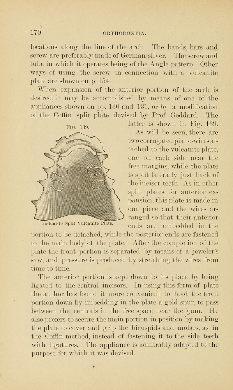 Fto. 139. locations along the line of the arch. The bands, bars and screw are preferably made of German silver. The screw and tube in which it operates being of the Angle pattern. Other ways of using the screw in connection with a vulcanite plate are shown on p. 154. When expansion of the anterior portion of the arch is desired, it may be accomjilished by means of one of the appliances shown on pp. 130 and 131, or by a modification of the Coffin split plate devised by Prof. Goddard. The latter is shown in Fig. 139. As will be seen, there are two corrugated piano-wires at- tached to the vulcanite plate, one on each side near the free margins, while the j)late is split laterally just back of the incisor teeth. As in other split plates for anterior ex- pansion, this plate is made in one piece and the wires ar- ranged so that their anterior ends are embedded in the portion to be detached, while the posterior ends are fastened to the main body of the plate. After the comj^letion of the plate the front portion is separated by means of a jeweler's saw, and pressure is produced by stretching the wires from time to time. The anterior portion is kept down to its place by being ligated to the central incisors. In using this form of plate the author has found it more convenient to hold the front portion down by imbedding in the plate a gold spur, to pass between the centrals in the free space near the gum. He also prefers to secure the main portion in position by making the plate to cover and grip the bicuspids and molars, as in the Coffin method, instead of fastening it to the side teeth with ligatures. The appliance is admirably adapted to the purpose for which it was devised. (j'oddard's Split Vulcanite Plate.