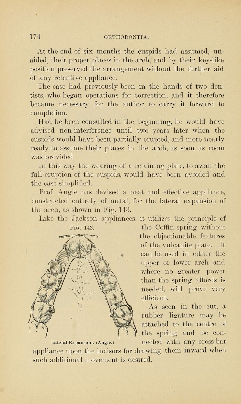 At the end of six months the cuspids had assumed, un- aided, their proper places in the arch, and by their key-hke position preserved the arrangement without the further aid of any retentive apphance. The case had previously been in the hands of two den- tists, who began operations for correction, and it therefore became necessary for the author to carry it forward to completion. Had he been consulted in the beginning, he would have advised non-interference until two years later when the cuspids would have been partially erupted, and more nearly ready to assume their places in the arch, as soon as room was provided. In this way the wearing of a retaining plate, to await the full eruj^tion of the cuspids, would have been avoided and the case simplified. Prof Angle has devised a neat and effective apj)liance, constructed entirely of metal, for the lateral expansion of the arch, as shown in Fig. 143. Like the Jackson appliances, it utilizes the principle of the objectionable features of the vulcanite plate. It can be used in either the upper or lower arch and where no greater power than the spring affords is needed, will prove very efficient. As seen in the cut, a rubber ligature may be attached to the centre of the spring and be con- Lateral Expansion. (Angle.) nCCtcd with any CrOSS-bar appliance upon the incisors for drawing them inward when such additional movement is desired.